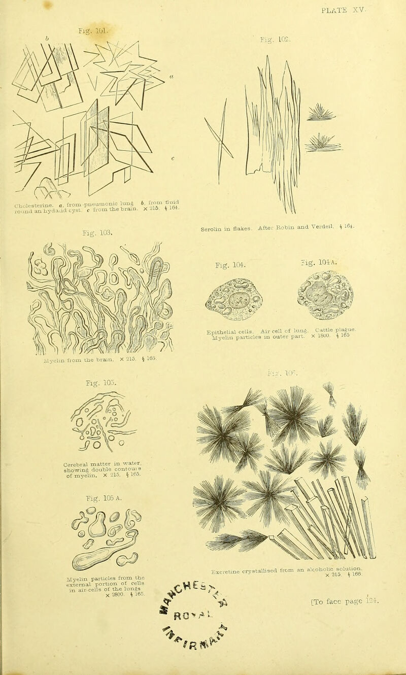 Fig. 101. Fig. LOS Cerebral matter in water, stowing double contom s of myelin. X 215. § 155. Fig. 105 A. Fig. 104. rig. 104 a. b ; V ' Epithelial cells. Air cell of lung. Cattle plague. Myelin particles in outer part. X IbOO. ^ 100 Myelin particles from the external portion of cells in air-cells of the lungs X 2800. f, 165. <? .Cwe- Excvetine crystallised from an alcohoto^ srtution. lA [To face page 124. RO>/» te* > „ wi f R