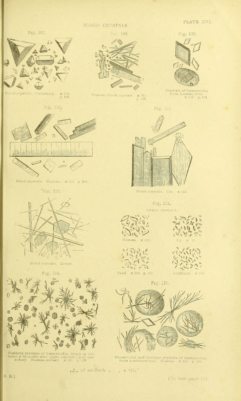 Fig. 107. BLOOD CRYSTALS. Fig. 103. Human blood crystals, x 215. p. 1*38. Fig. 109. Crystals of hasmatoidia from human liver X 215 p. 129. Blood crystals. Mouse. Fig. 114. Feathery crystals of hsematcidin, found in the urine a fortnight after slight rupture ( ) of one kidney. Human subject, x *215 j . l-j9 Pig. 113. H JEM IN CRYSTALS. xxV n D  »/7 1 Human, x 215. •%,(i v eh ^ A/ Id ^ —y -v- jfVV ) ^ r r Vv|iA- G old finch. x *215 Fig. 115. Rhombcidal and feathery crystals of hsemaloid-.n, from a softened clot. Human. X 215. p. i-jy. .B.] of an Inch , , x 215.