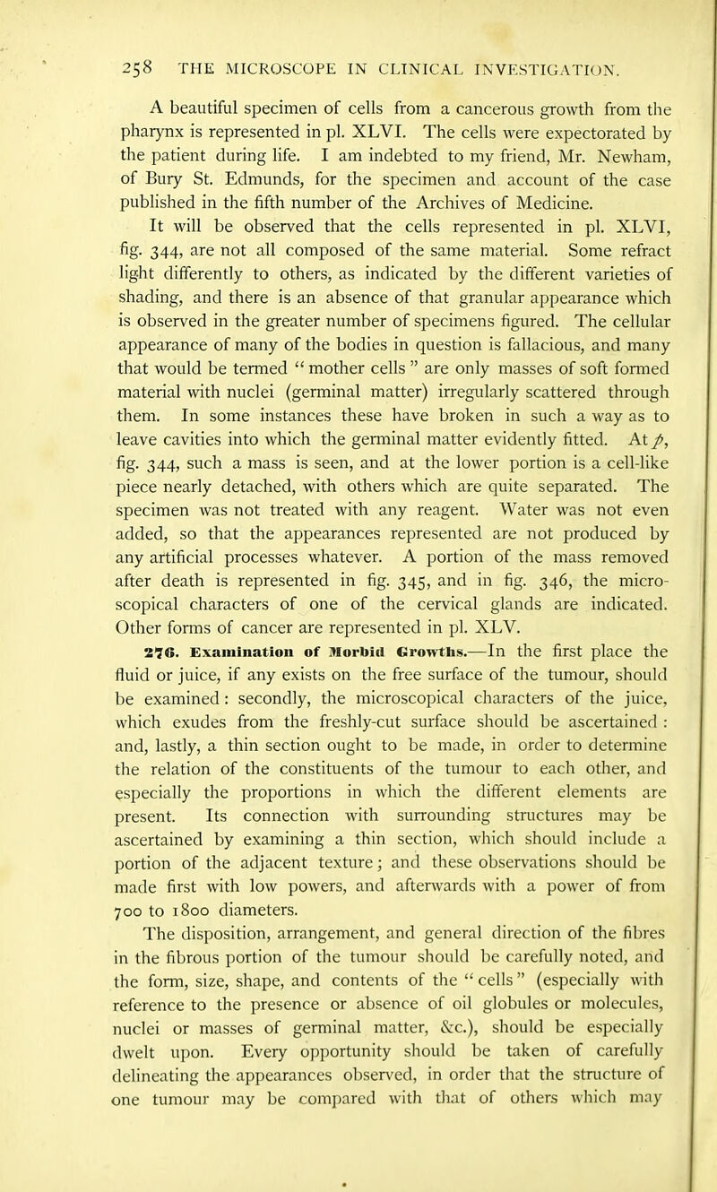 A beautiful specimen of cells from a cancerous growth from the pharynx is represented in pi. XLVI. The cells were expectorated by the patient during life. I am indebted to my friend, Mr. Newham, of Bury St. Edmunds, for the specimen and account of the case published in the fifth number of the Archives of Medicine. It will be observed that the cells represented in pi. XLVI, fig. 344, are not all composed of the same material. Some refract light differently to others, as indicated by the different varieties of shading, and there is an absence of that granular appearance which is observed in the greater number of specimens figured. The cellular appearance of many of the bodies in question is fallacious, and many that would be termed “ mother cells ” are only masses of soft formed material with nuclei (germinal matter) irregularly scattered through them. In some instances these have broken in such a way as to leave cavities into which the germinal matter evidently fitted. At p, fig. 344, such a mass is seen, and at the lower portion is a cell-like piece nearly detached, with others which are quite separated. The specimen was not treated with any reagent. Water was not even added, so that the appearances represented are not produced by any artificial processes whatever. A portion of the mass removed after death is represented in fig. 345, and in fig. 346, the micro- scopical characters of one of the cervical glands are indicated. Other forms of cancer are represented in pi. XLV. 276. Examination of Morbid Growths.—In the first place the fluid or juice, if any exists on the free surface of the tumour, should be examined : secondly, the microscopical characters of the juice, which exudes from the freshly-cut surface should be ascertained : and, lastly, a thin section ought to be made, in order to determine the relation of the constituents of the tumour to each other, and especially the proportions in which the different elements are present. Its connection with surrounding structures may be ascertained by examining a thin section, which should include a portion of the adjacent texture; and these observations should be made first with low powers, and afterwards with a power of from 700 to 1800 diameters. The disposition, arrangement, and general direction of the fibres in the fibrous portion of the tumour should be carefully noted, and the form, size, shape, and contents of the “cells” (especially with reference to the presence or absence of oil globules or molecules, nuclei or masses of germinal matter, &c.), should be especially dwelt upon. Every opportunity should be taken of carefully delineating the appearances observed, in order that the structure of one tumour may be compared with that of others which may