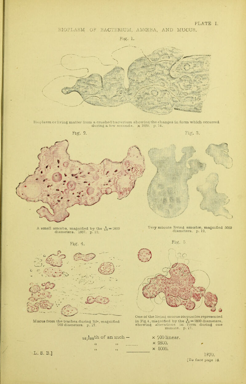 BIOPLASM OF BACTERIUM, AMCEBA, AND MUCUS. Fig.' 1. Bioplasm or living matter from a crushedbacterium showing the changes in form which occurred during a few seconds, x 1900. p. 14. Fig. 2. Mucus from the trachea during life, magnified 700 diameters, p. 17. One of the living mucus corpuscles represented in Fig.4, magnified by the = 2800 diameters, showing alterations in form during one minute, p. 17. io.uoo^ of an inch. — x '/OO linear, x 2800, x 5000. 1370: L. S. B.]