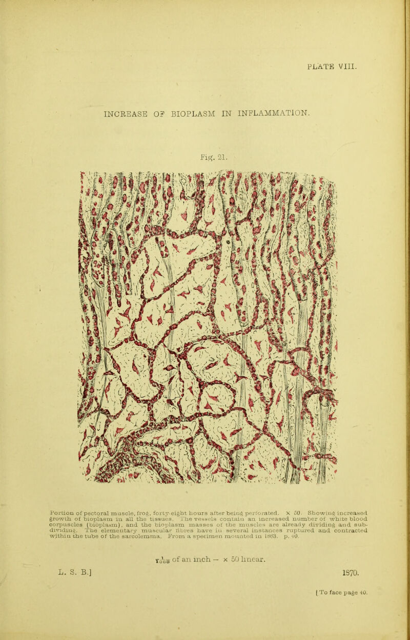 INCREASE O? BIOPLASM IN INFLAMMATION. Portion of pectoral muscle, frog, forty-eight hours after being perforated, x 50. Showing increased growth of bioplasm in all the tissues. The vessels contain an increased number of white blood corpuscles (bibplasm), and the bioplasm masses of the muscles are already dividing and sub- dividing. The elementary muscular dbres have in several instances ruptured and contracted within the tube of the sarcolemma. From a specimen mounted in ldt>3. p. 40. L. S.'B.J 10*00 °f an inch — x 50 linear. 1570.