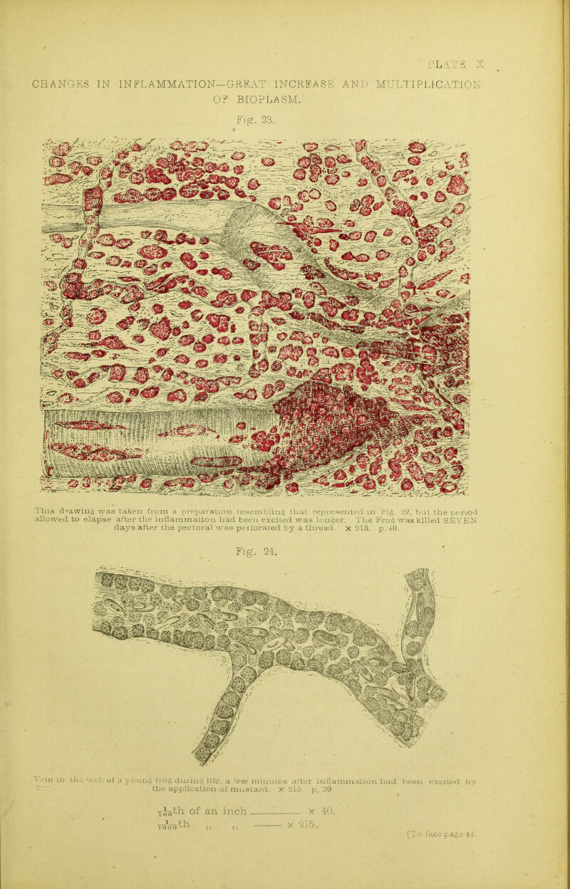 PLAT 3- X CHANGES IN INFLAMMATION—GREAT INCREASE AND MULTIPLICATION O? BIOPLASM. Fig. 23. This drawing was taken from a preparation resembling that represented in Fig. 22, but the period allowed to eiap'se after the inflammation had been excited was longer, The Frog was killed SEVEN days after the pectoral was perforated by a thread, x 215. p. 40. Fig. 24. \ ein in the web of a young frog during life, a few minutes alter inflammation had been excited by the application of mustard, x 215. p,’39 yifjth of an inch x 40. T5l(T„th ,, x 2J5. [To face page 44.