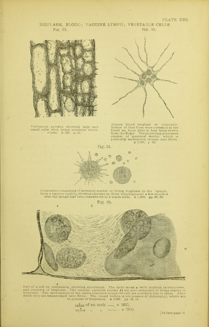 BIOPLASM, BLOOD; VACCINE LYMPH; VEGETABLE CELLS. Fig. .32. FU. 33. Vallisneria spiralis, showing large and. small cells wich living contents which. • rotate. X 130. p. 03. Altered blood bioplast or corpuscle. Bodies of this form were common in the blood an hour after it had been drawn from the finger. The projecting processes consist of germinal matter which is gradually undergoing change into fibrin. X 1,800. p 53. Fig. 34. 4' 9 gg|> =-L.ii -.iii-n < r~ . Corpuscles consisting of germinal matter or living bioplasm in the * lymph,' from a vaccine vesicle, showing changes in form which occured a few minutes after the lymph had been transferred to a warm slide. X 1,800. pp. 60, 62. Fig. 35. c b c Part of a cell in vallisneria, showing circulation. The large mass, a, with nucleus, is colourless, and consists of bioplasm. The smaller particles (under 6) are also composed of living matter or bioplasm. The movements of the entire conlents round the cell are probably due to these. After death they are transformed into fibrin. The round bodies, c, are masses of chlorophyl, which are in process of formation, x 2,800. pp 53,55. Toooo °f an inch x 1800. Tri£,-lS ,, „ — x 2S00.