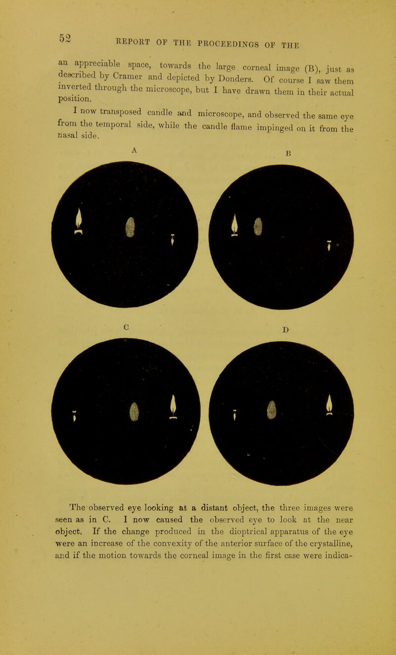 REPORT OF THE PROCEEDINGS OF THE an appreciable space, towards the large corneal image (B), just as described by Cramer and depicted by Donders. Of course I saw them inverted through the microscope, but I have drawn them in their actual position. I now transposed candle and microscope, and observed the same eye from the temporal side, while the candle flame impinged on it from the nasal side. The observed eye looking at a distant object, the three images were seen as in C. I now caused the observed eye to look at the near object. If the change produced in the dioptrical apparatus of the eye were an increase of the convexity of the anterior surface of the crystalline, and if the motion towards the corneal image in the first case were indica-