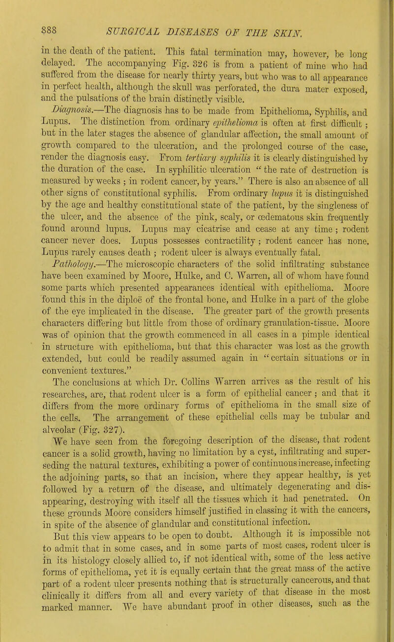 ill the dentil of the pntieiit. This fatnl teriiiinatioii tuny, however, be long delayed. The accompanying Fig. 320 is from a patient of mine who had suffered from the disease lor nearly thirty years, but who was to all appearance in perfect health, although the skull was perforated, the dura mater exposed, and the pulsations of the brain distinctly \dsible. Diagnosis.—The diagnosis has to be made from Epithelioma, Syphilis, and Lupus. The distinction from ordinary cjAtlielioma is often at first difficult; but in the later stages the absence of glandular affection, the small amount of growth compared to the ulceration, and the prolonged course of the case, render the diagnosis easy. From tertiary syphilis it is clearly distinguished by the duration of the case. In syphilitic ulceration “ the rate of destruction is measimed by weeks ; in rodent cancer, by years.” There is also an absence of all other signs of constitutional syphilis. From ordinary lupus it is distinguished by the age and healthy constitutional state of the patient, by the singleness of the ulcer, and the absence of the pink, scaly, or oedematous skin frequently found around lupus. Lupus may cicatrise and cease at any time ; rodent cancer never does. Lupus possesses contractihty; rodent cancer has none. Lupus rarely causes death ; rodent ulcer is always eventually fatal. Pathology.—The microscopic characters of the solid infiltrating substance have been examined by Moore, Hulke, and C. Warren, aU of whom have found some parts which presented appearances identical with epithelioma. Moore found this in the diploe of the frontal bone, and Hulke in a part of the globe of the eye implicated in the disease. The greater part of the growth presents characters differing but httle from those of ordinary granulation-tissue. Moore was of opinion that the growth commenced in aU cases in a pimple identical in structure with epithelioma, but that this character was lost as the growth extended, but could be readily assumed again in “ certain situations or in convenient textimes.” The conclusions at which Dr. Colhns Warren arrives as the result of his researches, are, that rodent ulcer is a form of epithelial cancer; and that it differs fr’om the more ordinary forms of epithehoma in the small size of the cells. The arrangement of these epithelial cells may be tubular and alveolar (Fig. 327). We have seen from the foregoing description of the disease, that rodent cancer is a solid growth, having no limitation by a cyst, infiltrating and super- seding the natural textures, exhibiting a power of continuous increase, infecting the adjoining parts, so that an incision, where they appear healthy, is yet followed by a return of the disease, and ultimately degenerating and dis- appearing, destroying with itself all the tissues which it had penetrated. On these grounds Moore considers himself justified in classing it with the cancels, in spite of the absence of glandular and constitutional infection. But this view appears to be open to doubt. Although it is impossible not i to admit that in some cases, and in some parts of most cases, rodent ulcei is in its histology closely allied to, if not identical with, some of the less active forms of epithelioma, yet it is equally certain that the great mass of the active part of a rodent ulcer presents nothing that is structurally cancerous, and that clinically it differs from all and every variety of that disease in the most marked manner. We have abundant proof in other diseases, such as the
