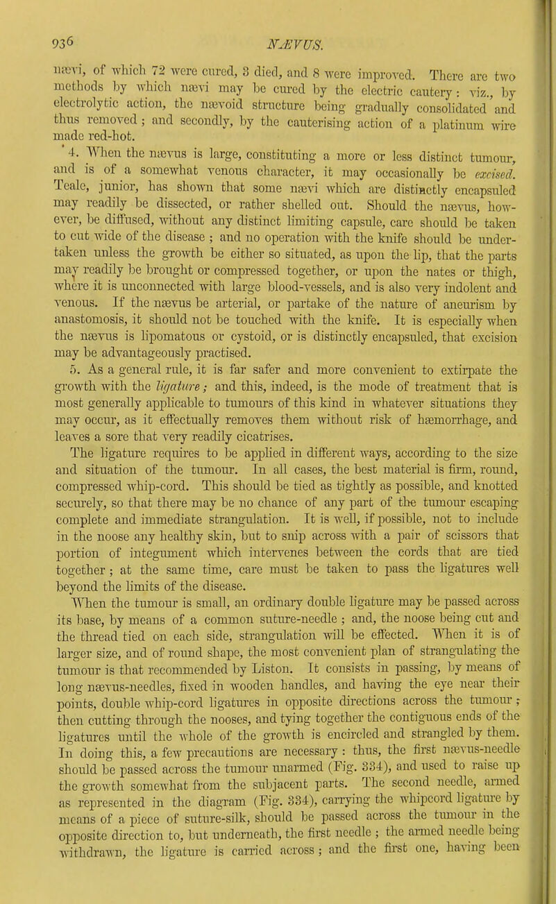 lum-i, of wliicli 72 were cured, 3 died, and 8 were improved. There are two niotiiods hy which nmvi may be cured by the electric cautery; \iz., by electrolytic action, the ntevoid structure being gi-adually consolidated and thus removed ; and secondly, by the cauterising action of a platinum wire made red-hot. 4. ■^\hen the nmvus is large, constituting a more or less distinct tumour, and is of a somewhat venous character, it may occasionally be excised. Icale, junior, has shoAvn that some nmvi which are distinctly encapsuled may readily be dissected, or rather shelled out. Should the naevus, how- ever, be diifused, without any distinct limiting capsule, care should be taken to cut wide of the disease ; and no operation with the knife should be under- taken unless the growth be either so situated, as upon the lip, that the parts ma^ readily be brought or compressed together, or upon the nates or thigh, where it is unconnected with large blood-vessels, and is also very indolent and venous. If the naevus be arterial, or partake of the nature of aneurism by anastomosis, it should not be touched with the knife. It is especially when the nmvus is lipomatous or cystoid, or is distinctly encapsuled, that excision may be advantageously practised. 5. As a general rule, it is far safer and more convenient to extirpate the gi’owth with the ligature; and this, indeed, is the mode of treatment that is most generally applicable to tumours of this kind in whatever situations they may occur, as it effectually removes them without risk of hmmon’hage, and leaves a sore that very readily cicatrises. The ligature requires to be applied in different ways, according to the size and situation of the tumoiu-. In all cases, the best material is firm, round, compressed whip-cord. This should be tied as tightly as possible, and knotted seciu’ely, so that there may be no chance of any part of the tumour escaping complete and immediate strangulation. It is well, if possible, not to include in the noose any healthy skin, but to snip across with a pair of scissors that portion of integument which intervenes between the cords that are tied together; at the same time, care must be taken to pass the ligatures well beyond the limits of the disease. When the tumour is small, an ordinary double h'gature may be passed across its base, by means of a common suture-needle ; and, the noose being cut and the thread tied on each side, strangulation wiU be effected. lATien it is of larger size, and of round shape, the most convenient plan of strangulating the tumour is that recommended by Liston. It consists in passing, by means of long naevus-needles, fixed in wooden handles, and having the eye near their points, double whip-cord ligatures in opposite directions across the tiunoiu’; then cutting through the nooses, and tying together the contiguous ends of the ligatures until the Avhole of the groAvth is encircled and strangled by them. In doing this, a few precautions are necessary: thus, the first lueA us-necdle should be passed across the tumour unarmed (Fig. 834), and used to raise up the gTowth somewhat from the subjacent pai'ts. dhe second needle, aimed as represented in the diagram (Fig. 334), carrying the whipcord ligature by means of a piece of suture-silk, should be passed across the tumour in the opiposite direction to, but underneath, the first needle ; the aimed neepe being Avithdrawn, the ligature is caiTicd across ; and the first one, haAing been