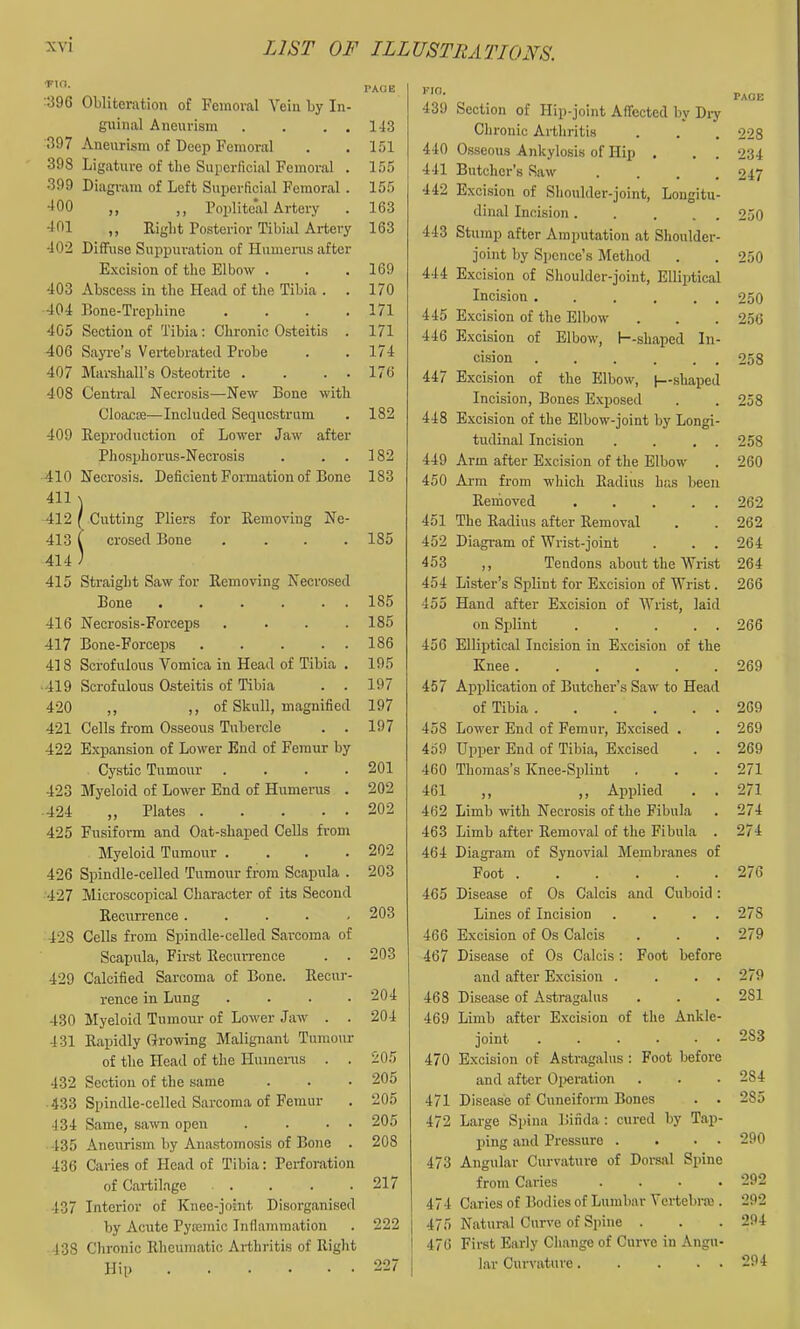 •FIO. ■396 Obliteration of Femoral Vein by In- guinal Aneurism . . . . 397 Aneurism of Deep Femoral 398 Ligature of the Superficial Femoral . 399 Diagram of Left Superficial Femoral. •100 ,, ,, Poplite*al Artery -101 ,, Eight Posterior Tibial Artery -10'2 Diffuse Suppuration of Humerus after Excision of the Elbow . 403 Abscess in the Head of the Tibia . 404 Bone-Trephine .... 405 Section of Tibia; Chronic Osteitis . 406 Sayre’s Vertebrated Probe 407 Marshall’s Osteotrite . . . . 408 Central Necrosis—New Bone with Cloaeoa—Included Sequestrum 409 Eeproduction of Lower Jaw after Phosijhorus-Necrosis 410 Necrosis. Deficient Formation of Bone 411 41-2 413 414 415 Straight Saw for Eemoving Necrosed Bone ...... 416 Necrosis-Forceps .... 417 Bone-Forceps ..... 418 Scrofulous Vomica in Head of Tibia . 419 Scrofulous Osteitis of Tibia . . 4'20 ,, j; of Skull, magnified 421 Cells from Osseous Tubercle . . 422 Expansion of Lower End of Femur by Cystic Tumour .... 423 Myeloid of Lower End of Humerus . 424 ,, Plates ..... 425 Fusiform and Oat-shaped Cells from Myeloid Tumour .... 426 Spindle-celled Tumour from Scapula . 427 Microscopical Character of its Second Eecurrence ..... 428 Cells from Spindle-ceUed Sarcoma of Scapula, First Eecurrence . . 429 Calcified Sarcoma of Bone. Eecur- rence in Lung .... 430 Myeloid Tumour of Lower Jaw . . 431 Eapidly (irowing Malignant Tumour of the Head of the Humenis . . 432 Section of the same 433 Spindle-celled Sarcoma of Femur 434 Same, sawn open . . . • 435 Aneurism by Anastomosis of Bone . 436 Caries of Head of Tibia: Perforation of Cai-tilage . 437 Interior of Knee-joint Disorganised by Acute Pyremic Inflammation 438 Chronic Eheumatic Arthritis of Eight Hip Cutting Pliers crosed Bone for Eemoving Ne- PAOE 143 151 155 155 163 163 169 170 171 171 174 176 182 182 183 185 185 185 186 195 197 197 197 201 202 202 202 203 203 203 204 204 205 205 205 205 208 217 222 227 Kin. 439 Section of Hip-joint Affected by Dry Clironic Arthritis 440 Osseous Ankylosis of Hip . 441 Butcher’s Saw .... 442 Excision of Shoulder-joint, Longitu- dinal Incision. . ... 443 Stump after Amputation at Shoulder- joint by Spence’s Method 444 Excision of Shoulder-joint, Elliptical Incision 445 E.xcision of the Elbow 446 Excision of Elbow, 1~-shaped In- cision . . . . . . 447 Excision of the Elbow, f--shaped Incision, Bones Exposed 448 Excision of the Elbow-joint by Longi- tudinal Incision . . . . 449 Arm after Excision of the Elbow 450 Arm from which Eadius has been Eemoved ..... 451 The Eadius after Eemoval 452 Diagram of Wrist-joint . . . 453 ,, Tendons about the Wrist 454 Lister’s Splint for Excision of Wrist. 455 Hand after Excision of Wrist, laid on Spjlint . .... 456 Elliptical Incision in Excision of the Knee ...... 457 Application of Butcher’s Saw to Head of Tibia 458 Lower End of Femur, Excised . 459 Upper End of Tibia, Excised . . 460 Thomas’s Knee-Splint 461 ,, ,, Applied . . 462 Limb with Necrosis of the Fibula 463 Limb after Eemoval of the Fibula . 464 Diagram of Synovial Membranes of Foot ...... 465 Disease of Os Calcis and Cuboid : Lines of Incision . . . . 466 Excision of Os Calcis 467 Disease of Os Calcis : Foot before and after Excision . . . . 468 Disease of Astragalus 469 Limb after Excision of the Ankle- joint 470 Excision of Astragalus : Foot before and after Oiieration 471 Disease of Cuneiform Bones . . 47‘2 Large Spina Bifida: cured by Tapi- ping and Pressure . . • • 473 Angular Curvature of Dorsal Spine from Caries .... 474 Caries of Bodies of Lumbar Vertebi-ai. 475 Natural Curve of Spine . 476 First Early Change of Curve in Angu- lar Curvature. . ... PAGE 228 234 247 250 250 250 256 258 258 258 260 262 262 264 264 266 266 269 269 269 269 271 271 274 274 276 278 279 279 281 283 284 285 290 292 292 294 294