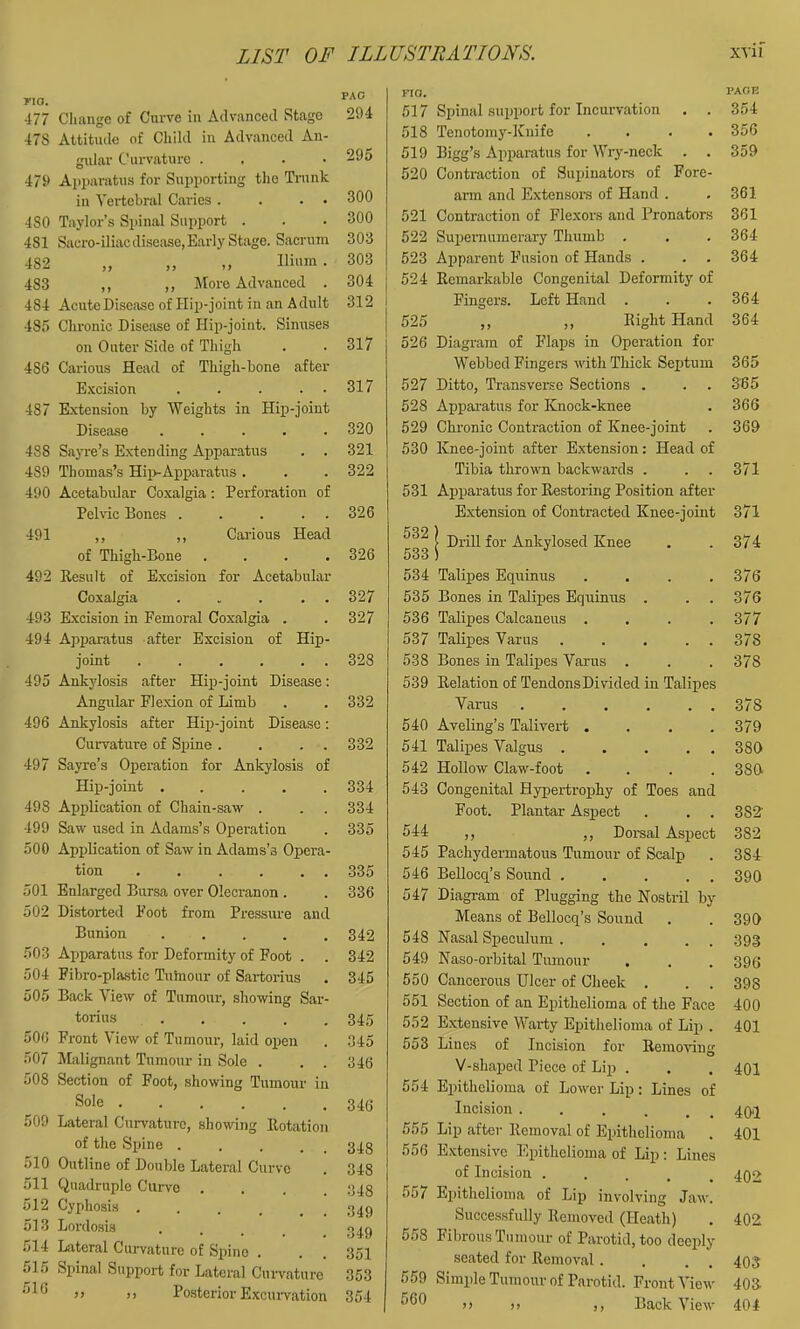 yio. 477 Change of Cnrve in Advanced Stage 47S Attitude of Child in Advanced An- gular Curvature . . . • 479 Apparatus for Supporting the Trunk in Veidebral Caries . . . • 480 Taylor’s Spinal Support . 481 Siicro-iliac disease, Early Stage. Sacrum 482 „ „ „ Ilium. 483 ,, ,, More Advanced . 484 Acute Disease of Hip-joint in an Adult 485 Chronic Disease of Hip-joint. Sinuses on Outer Side of Thigh 486 Carious Head of Thigh-bone after Excision . . . . . 487 Extension by Weights in Hip-joint Disease ..... 488 Sayi'e’s Extending Apparatus . . 489 Thomas’s Hii>Apparatus . 490 Acetabular Coxalgia; Perforation of Pehic Bones ..... 491 ,, ,, Carious Head of Thigh-Bone .... 492 Result of E.xcision for Acetabular Coxalgia ... . . 493 Excision in Femoral Coxalgia . 494 Apparatus after Excision of Hip- joint . . . . . . 495 Ankylosis after Hip-joint Disease: Angular Flexion of Limb 496 Ankylosis after Hip-joint Disease: Curvature of Spine . . . . 497 Sayre’s Operation for Ankylosis of Hip-joint ..... 498 Application of Chain-saw . 499 Saw used in Adams’s Operation 500 Application of Saw in Adams’s Opera- tion . . . . . , 501 Enlarged Bursa over Olecranon . 502 Distorted Foot from Pressru-e and Bunion ..... 503 Apparatus for Deformity of Foot . 504 Fibro-plastic Tuhiour of Sartorius 505 Back View of Tumour, showing Sar- torius ..... 506 Front View of Tumour, laid open 507 Malignant Tumour in Sole . . . 508 Section of Foot, showing Tumour in Sole ...... 509 Lateral Curvature, showing Rotation of the Spine . 510 Outline of Double Lateral Curve 511 Quadruple Curve .... 512 Cyphosis ...... 513 Lordosis .... 514 Ltiteral Curvature of Spine . 515 Spinal Support for Lateral Cuiwature ” )> Posterior Exemwation PAD 294 295 300 300 303 303 304 312 317 317 320 321 322 326 326 327 327 332 332 334 334 335 335 336 342 342 345 345 .345 346 346 348 348 .348 349 349 351 353 354 no. 517 Spinal support for Incurvation 518 Tenotomy-Knife . . . . 519 Bigg’s Apparatus for Wry-neck . . 520 Contraction of Supinators of Fore- arm and Extensore of Hand . 521 Contraction of Flexors and Pronators 522 Supernumerary Thumb . 523 Apparent Fusion of Hands . 524 Remarkable Congenital Deformity of Fingers. Left Hand . 525 ,, ,, Right Hand 526 Diagram of Flaps in Operation for Webbed Fingers with Thick Septum 527 Ditto, Transverse Sections . 528 Appai’atus for Knock-knee 529 Chronic Contraction of Knee-joint 530 Knee-joint after Extension: Head of Tibia thrown backwards . 531 Apparatus for Restoring Position after Extension of Contracted Knee-joint I Drill for Ankylosed Knee 534 Talipes Equinus .... 535 Bones in Talipes Equinus . 536 Talipes Calcaneus .... 537 Talipes Varus . . . . . 538 Bones in Talipes Varus . 539 Relation of TendonsDivided in Talipes Varus . . . . . . 540 Aveling’s Talivert .... 541 Talixjes Valgus . . . . . 542 Hollow Claw-foot .... 543 Congenital Hypertroi)hy of Toes and Foot. Plantar Aspect 544 ,, ,, Dorsal Asj)ect 545 Pachydermatous Tumour of Scalp 546 BeUocq’s Sound ..... 547 Diagram of Plugging the Nostril by Means of Bellocq’s Sound 548 Nasal Speculum . . ... 549 Naso-orbital Tumour 550 Cancerous Ulcer of Cheek . . . 551 Section of an Exsithelioma of the Face 552 Extensive Warty Epithelioma of Lip . 553 Lines of Incision for Removing V-shaped Piece of Lip . 554 Epithelioma of Lower Lip: Lines of Incision ...... 555 Lip after Removal of Epithelioma 556 Extensive Epithelioma of Lip: Lines U1 AIIUISIUU 557 Epithelioma of Lip involving Jai Successfully Removed (Heath) 558 Fibrous Tumour of Parotid, too deep seated for Removal. 559 Simple Tumour of Parotid. Front Vie 560 Back Vi( PAOB 354 356 359 361 361 364 364 364 364 365 3B5 366 369 371 371 374 376 376 377 378 378 378 379 380 380 382- 382 384 390 390 393 396 398 400 401 401 401 401 402 402 403 403 404