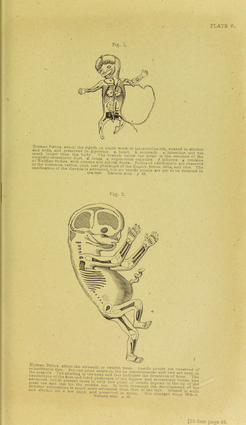 I Fig. 1. Sd eoda and meseLed •^ nmth Teek of i“t™«-rine life, soaked in alcohol much loniw than thehod J y°mh“ev. !leart' b stomach, c. intestine, not yet omphalo.mesemerie^? jy, Ths branch below i-be letter is the remains of the of Wolffian bodies d'- itings. e, supra-renal capsules, /.kidneys g remains in thehumerus re'dni h °,van?s aud ^a,tal ci“‘t8• Poiut® of ossification ar? observed ossification of the elV'°a’ a8t Phalan,!es °f the fingers, femur, tibia, and ribs The ossification of the clavicle is advanced, but no ossiflc points are yet to be detected in tne ieet Natural size, p 48. Fig. 2. ooasidOT^etUsiieBb0Bu^e^poiS^sts^el|£ TCe°k 0ssiQc P°’nt9 are observ, the scapula The shadint hoTo t3 ,t,e oa 'nnominatum and two are sei ossification of ihe first and thin? nf3? apd f'1ce tt’dicates the formation of bone advanced, but at present ^ere^onlt”^0' the fl^ars aud m«acarpal bones ^«i.° toy..“?npssh tegs o° -—-raajfei [To face page 43.