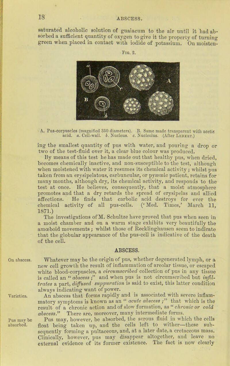 saturated alcoholic solution of guaiacmn to the air until it had ab- sorbed a sufficient quantity of oxygen to give it the property of turning green when placed in contact with iodide of potassium. On moisten- Eig. 2. I j i A. Pua-corpuscles (magnified 350 diameters). B. Same made transparent with acetic acid. a. Cell-wall. i. Nucleus, c. Nucleolus. (After Lebeet.) ing the smallest quantity of pus with water, and pouring a drop or two of the test-fluid over it, a clear blue colour was produced. By means of this test he has made out that healthy pus, when dried, becomes chemically inactive, and non-susceptible to the test, although when moistened with water it resumes its chemical activity; whilst pus taken from an erysipelatous, carbuncular, or pyajmic patient, retains for many months, although dry, its chemical activity, and responds to the test at once. He believes, consequently, that a moist atmosphere promotes and that a dry retards the spread of erysipelas and allied affections. He finds that carbolic acid destroys for ever the chemical activity of all pus-cells. (‘Med. Times,’ March 11, 1871.) The investigations ofM. Schultze have proved that pus when seen in a moist chamber and on a warm stage exhibits very beautifully the amoeboid movements ; whilst those of Recklinghausen seem to infficate that the globular appearance of the pus-ceD is indicative of the death of the cell. ABSCESS. On abscess. Whatever may be the origin of pus, whether degenerated lymph, or a new cell growth the result of inflammation of areolar tissue, or escaped white blood-corpuscles, a circumscribed collection of pus in any tissue is called an “ abscess and when pus is not circumscribed but infil- trates a part, diffused suppuration is said to exist, this latter condition always indicating want of power. Varieties. An abscess that forms rapidly and is associated with severe inflam- matory symptoms is known as an “ acute abscess that which is the result of a chronic action and of slov/ formation, as “ chronic or cold abscess.” There are, moreover, many intermediate forms. Pus may be Pus may, however, be absorbed, the serous fluid in which the cells absorbed. float being taken up, and the cells left to wither—these sub- sequently forming a pultaceous, and, at a later date, a cretaceous mass. Clinically, however, pus may disappear altogether, and leave no external evidence of its former existence. The fact is now clearly