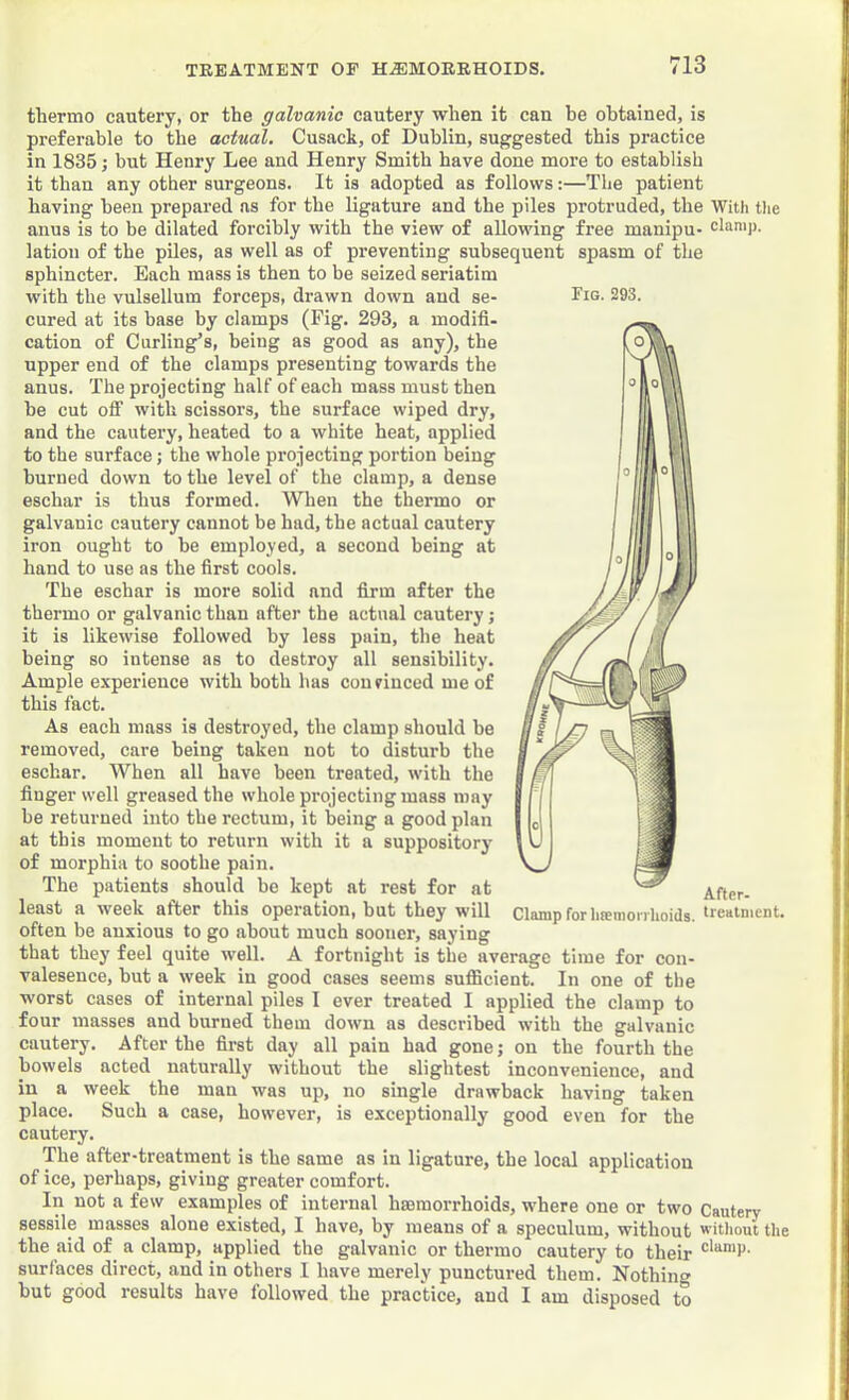 thermo cautery, or the galvanic cautery when it can be obtained, is preferable to the actual. Cusack, of Dublin, suggested this practice in 1835; but Henry Lee and Henry Smith have done more to establish it than any other surgeons. It is adopted as follows:—The patient having been prepared as for the ligature and the piles protruded, the Witli ttie anus is to be dilated forcibly with the view of allowing free manipu- daa'P- lation of the piles, as well as of preventing subsequent spasm of the sphincter. Each mass is then to be seized seriatim with the vulsellum forceps, drawn down and se- cured at its base by clamps (Fig. 293, a modifi- cation of Curling’s, being as good as any), the upper end of the clamps presenting towards the anus. The projecting half of each mass must then he cut olF with scissors, the surface wiped dry, and the cautery, heated to a white heat, applied to the surface; the whole projecting portion being burned down to the level of the clamp, a dense eschar is thus formed. When the thermo or galvanic cautery cannot be had, the actual cautery iron ought to he employed, a second being at hand to use as the first cools. The eschar is more solid and firm after the thermo or galvanic than after the actual cautery j it is likewise followed by less pain, the heat being so intense as to destroy all sensibility. Ample experience with both has convinced me of this fact. As each mass is destroyed, the clamp should be removed, care being taken not to disturb the eschar. When all have been treated, with the finger well greased the whole projecting mass may be returned into the rectum, it being a good plan at this moment to return with it a suppository of morphia to soothe pain. The patients should be kept at rest for at least a week after this operation, but they will often be anxious to go about much sooner, saying that they feel quite well. A fortnight is the average time for con- valeseuce, hut a week in good cases seems sufficient. In one of the worst cases of internal piles I ever treated I applied the elamp to four masses and burned them down as described with the galvanic cautery. After the first day all pain had gone; on the fourth the bowels acted naturally without the slightest inconvenience, and in a week the man was up, no single drawback having taken place. Such a ease, however, is exeeptionally good even for the cautery. The after-treatment is the same as in ligature, the local application of ice, perhaps, giving greater comfort. In not a few examples of internal haemorrhoids, where one or two Cautery sessile masses alone existed, I have, by means of a speculum, without witliout the the aid of a clamp, applied the galvanic or thermo cautery to their surfaces direct, and in others I have merely punctured them. Nothing hut good results have followed the practice, and I am disposed to Fig. 293.