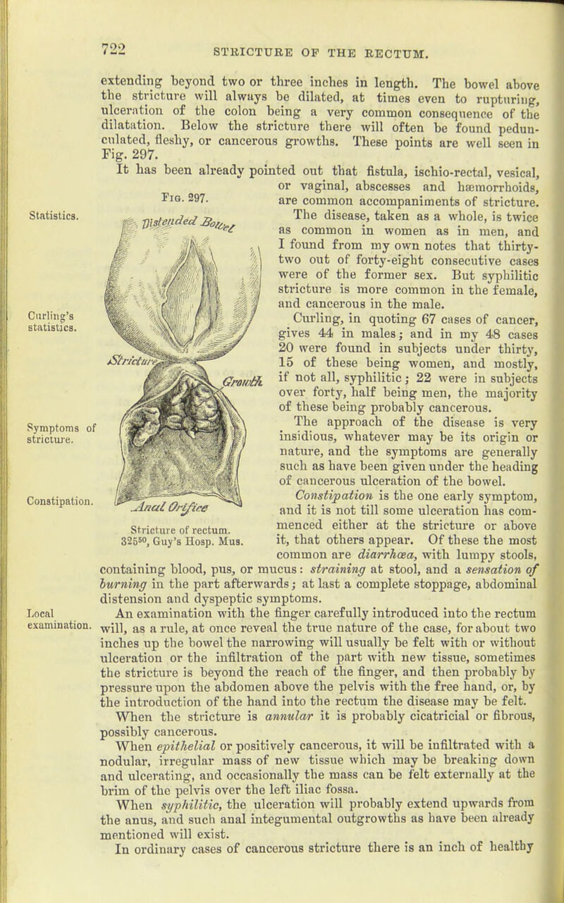 Statistics. Curling’s statistics. Symptoms of stricirue. Constipation. Local examination. 722 extending 'beyond two or three inches in length. The bowel above the stricture will always be dilated, at times even to rupturing, ulceration of the colon being a very common consequence of the dilatation. Below the stricture there will often he found pedun- culated, fleshy, or cancerous growths. These points are well seen in Fig. 297. It has been already pointed out that fistula, ischio-rectal, vesical, or vaginal, abscesses and hemorrhoids, are common accompaniments of stricture. The disease, taken as a whole, is twice as common in women as in men, and I found from my own notes that thirty- two out of forty-eight consecutive cases were of the former sex. But syphilitic stricture is more common in the female, and cancerous in the male. Curling, in quoting 67 cases of cancer, gives 44 in males; and in my 48 cases 20 were found in subjects under thirty, 15 of these being women, and mostly, if not all, syphilitic ; 22 were in subjects over forty, half being men, the majority of these being probably cancerous. The approach of the disease is very iusidious, whatever may be its origin or nature, and the symptoms are generally such as have been given under the heading of cancerous ulceration of the bowel. Constipation is the one early symptom, and it is not till some ulceration has com- menced either at the stricture or above it, that others appear. Of these the most common are diarrhoea, with lumpy stools, containing blood, pus, or mucus: straining at stool, and a sensation of lurning in the part afterwards; at last a complete stoppage, abdomind distension and dyspeptic symptoms. An examination with the finger carefully introduced into the rectum will, as a rule, at once reveal the true nature of the case, for about two inches up the bowel the narrowing will usually be felt with or without ulceration or the infiltration of the part with new tissue, sometimes the stricture is beyond the reach of the finger, and then probably by pressure upon the abdomen above the pelvis with the free hand, or, by the introduction of the hand into the rectum the disease may be felt. ■When the stricture is annular it is probably cicatricial or fibrous, possibly cancerous. When epithelial or positively cancerous, it will be infiltrated with a nodular, irregular mass of new tissue which may be breaking down and ulcerating, and occasionally the mass can be felt externally at the brim of the pelvis over the left iliac fossa. When syphilitic, the ulceration will probably extend upwards from the anus, and such anal integumental outgrowths as have been already mentioned will exist. In ordinary cases of cancerous stricture there is an inch of healthy Fig. 297. gislepded ^Inai Ory^ire Stricture of rectum. 326^0, Guy’s Hosp. Mus.