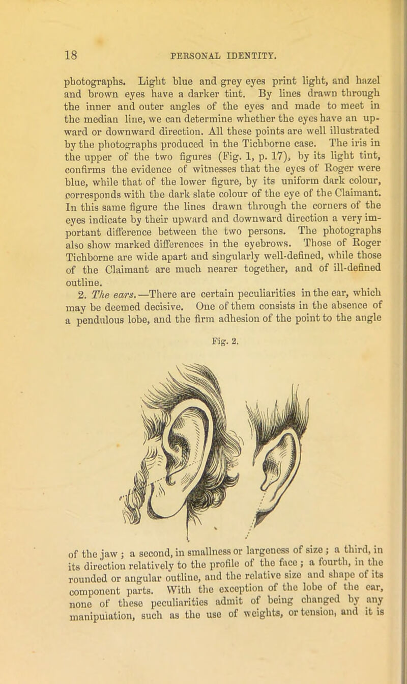 photographs. Light blue and grey eyes print light, and hazel and brown eyes have a darker tint. By lines drawn through the inner and outer angles of the eyes and made to meet in the median line, we can determine whether the eyes have an up- ward or downward direction. All these points are well illustrated by the photographs produced in the Tichborne case. The iris in the upper of the two figures (Fig. 1, p. 17), by its light tint, confirms the evidence of witnesses that the eyes of Eoger were blue, while that of the lower figure, by its uniform dark colour, corresponds with the dark slate colour of the eye of the Claimant. In this same figure the lines drawn through the corners of the eyes indicate by their upward and downward direction a very im- portant difference between the two persons. The photographs also show marked differences in the eyebrows. Those of Eoger Tichhorne are wide apart and singularly well-defined, while those of the Claimant are much nearer together, and of Hi-defined outline. 2. The ears. —There are certain peculiarities in the ear, which may be deemed decisive. One of them consists in the absence of a pendidous lobe, and the firm adhesion of the point to the angle of the jaw ; a second, in smallness or largeness of size; a third, in its direction relatively to the profile of the face ; a fourth, in the rounded or angular outline, and the relative size and shape of its component parts. With the exception of the lobe of the car, none of these peculiarities admit of being changed by any manipulation, such as the use of weights, or tension, and it is Fig. 2.