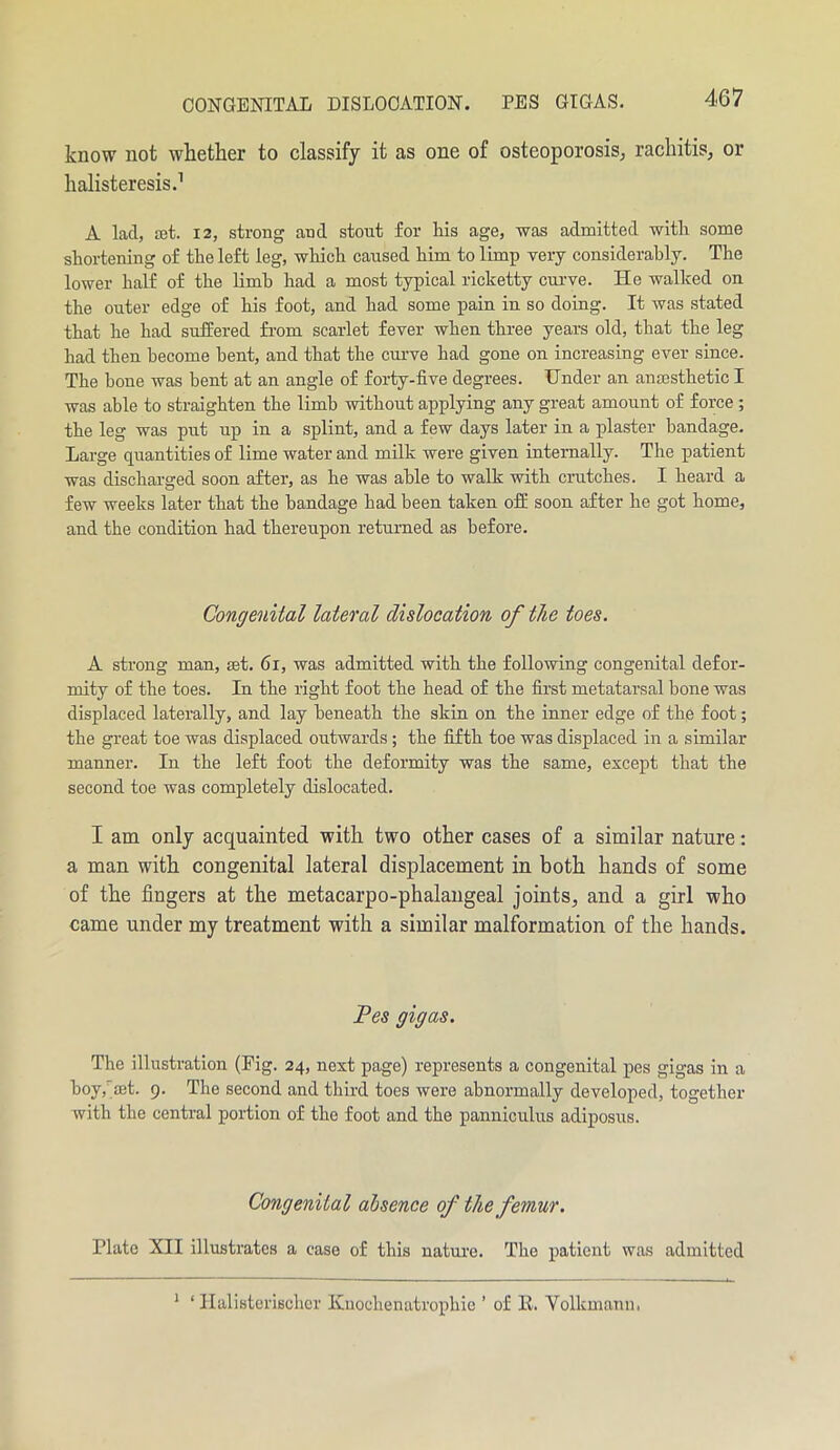 CONGENITAL DISLOCATION. PES GIGAS. know not whether to classify it as one of osteoporosis, rachitis, or halisteresis.1 A lacl, ret. 12, strong aud stout for his age, was admitted with some shortening of the left leg, which caused him to limp very considerably. The lower half of the limb had a most typical riclietty curve. He walked on the outer edge of his foot, and had some pain in so doing. It was stated that he had suffered from scarlet fever when three years old, that the leg had then become bent, and that the curve had gone on increasing ever since. The bone was bent at an angle of forty-five degrees. Under an anresthetic I was able to straighten the limb without applying any great amount of force ; the leg was put up in a splint, and a few days later in a plaster bandage. Large quantities of lime water and milk were given internally. The patient was discharged soon after, as he was able to walk with crutches. I heard a few weeks later that the bandage had been taken off soon after he got home, and the condition had thereupon returned as before. Congenital lateral dislocation of the toes. A strong man, set. 61, was admitted with the following congenital defor- mity of the toes. In the right foot the head of the first metatarsal bone was displaced laterally, and lay beneath the skin on the inner edge of the foot; the great toe was displaced outwards; the fifth toe was displaced in a similar manner. In the left foot the deformity was the same, except that the second toe was completely dislocated. I am only acquainted with two other cases of a similar nature: a man with congenital lateral displacement in both hands of some of the fingers at the metacarpo-phalangeal joints, and a girl who came under my treatment with a similar malformation of the hands. Fes gigas. The illustration (Pig. 24, next page) represents a congenital pes gigas in a boy,'set. 9. The second and third toes were abnormally developed, together with the central portion of the foot and the panniculus adiposus. Congenital absence of the femur. Plate Nil illustrates a case of this nature. The patient was admitted 1 ‘ Halisterischcr Knochenatrophie ’ of R. Volkmann.