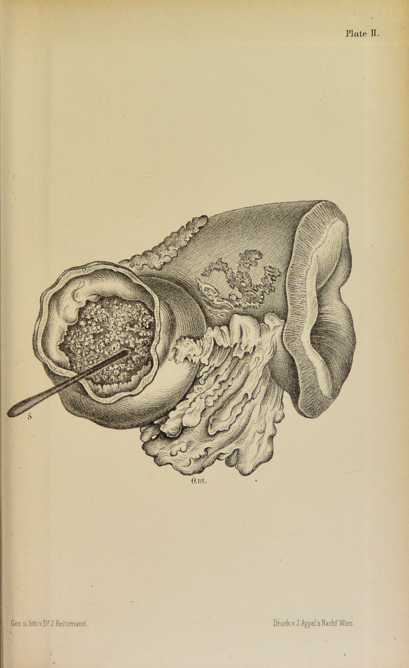 Gez. u.lilh v.T)r J Heitzmann. Druckv J.AppelsHacMWien.