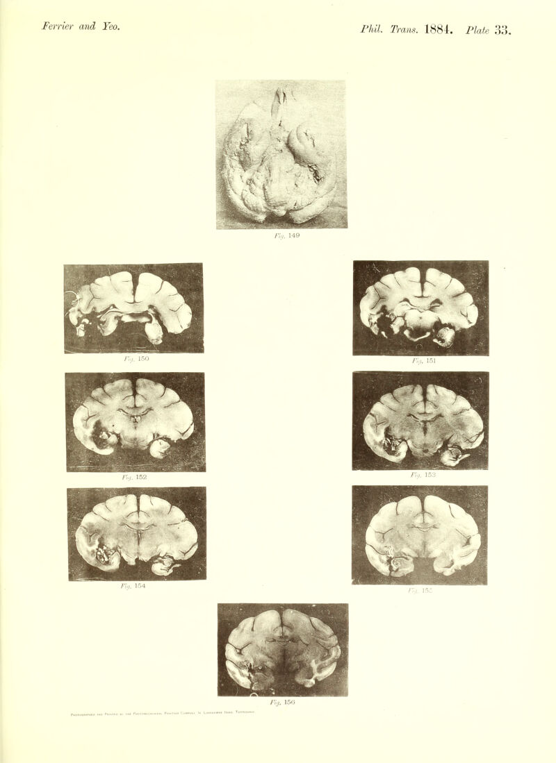 Fin. 149 Fij. 150 Fi:i. 151 Fii/. 152 Fin. 153 Fiij. 154 155 Fig. 156 pMOTOO«*PMtD pMOrOM«CM'*NlO*l Pllll.TlHO C'OVPAN* L»N900WNe 1(0*0. ToTTtNHAM