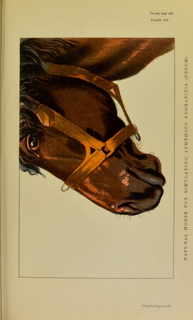 Facing page 406. PLATK XX. A TuiWit^rxchCiKvif &d 'wJiitA. NATURAL HORSE POX SIMULATING APHTHOUS STOMATITIS (PEUOH).