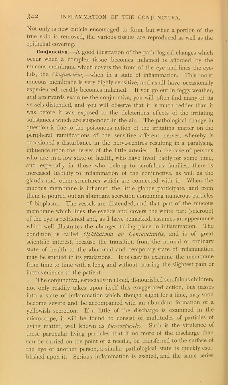 Not only is new cuticle encouraged to form, but when a portion of the true skin is removed, the various tissues are reproduced as well as the epithelial covering. Cimjuiictiva.—A good illustration of the pathological changes which occur when a complex tissue becomes inflamed is afforded by the mucous membrane which covers the front of the eye and lines the eye- lids, the Conjunctiva^—when in a state of inflammation. This moist mucous membrane is very highly sensitive, and as all have occasionally experienced, readily becomes inflamed. If you go out in foggy weather, and afterwards examine the conjunctiva, you will often find many of its vessels distended, and you will observe that it is much redder than it was before it was exposed to the deleterious effects of the irritating substances which are suspended in the air. The pathological change in question is due to the poisonous action of the irritating matter on the peripheral ramifications of the sensitive afferent nerves, whereby is occasioned a disturbance in the nerve-centres resulting in a paralysing influence upon the nerves of the little arteries. In the case of persons who are in a low state of health, who have lived badly for some time, and especially in those who belong to scrofulous families, there is increased liability to inflammation of the conjunctiva, as well as the glands and other structures which are connected with it. When the mucous membrane is inflamed the little glands participate, and from them is poured out an abundant secretion containing numerous particles of bioplasm. The vessels are distended, and that part of the mucous membrane which lines the eyelids and covers the white part (sclerotic) of the eye is reddened and, as I have remarked, assumes an appearance which well illustrates the changes taking place in inflammation. The condition is called Ophthah7iia or Conjunctivitis, and is of great scientific interest, because the transition from the normal or ordinary state of health to the abnormal and temporary state of inflammation may be studied in its gradations. It is easy to examine the membrane from time to time with a lens, and without causing the slightest pain or inconvenience to the patient. The conjunctiva, especially in ill-fed, ill-nourished scrofulous children, not only readily takes upon itself this exaggerated action, but passes into a state of inflammation which, though slight for a time, may soon become severe and be accompanied with an abundant formation of a yellowish secretion. If a little of the discharge is examined in the microscope, it will be found to consist of multitudes of particles of living matter, well known as pus-corpuscles. Such is the virulence of these particular living particles that if no more of the discharge than can be carried on the point of a needle, be transferred to the surface of the eye of another person, a similar pathological state is quickly esta- blished upon it. Serious inflammation is excited, and the same series