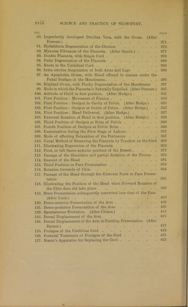 FlU. ilO. Imperfectly develo23ed Decidua Vera, with the Ovum. (After Duncan.) 91. Hydatiform Degeneration of the Chorion 92. Myxoma Pibrosum of the Placenta. (After Storch.) . 93. Double Placenta, with Single Cord ....... 94. Fatty Degeneration of the Placenta 96. Knots in the Umbilical Cord ........ 96. Intra-uterine Amputation of both Arms and Legs 97. An Apoplectic Ovum, with Blood effused in masses under the Foetal Surface of the Membranes 98. Blighted Ovum, with Fleshy Degeneration of the Membranes 99. Mode in which the Placenta is Naturally Expelled. (After Duncan.) 100. Attitude of Child in first position. (After Hodge.) . . . . 101. First Position : Movement of Flexion ...... 102. First Position : Occiput in Cavity of Pelvis. (After Hodge.) . . 103. First Position : Occiput at Outlet of Pelvis. (After Hodge.) 104. First Position : Head Delivered. (After Hodge.) . . . . 105. External Eotation of Head in first position. (After Hodge.) 106. Third Position of Occiput at Brim of Pelvis 107. Fourth Position of Occiput at Pelvic Brim 108. Examination during the First Stage of Labour . . . . 109. Mode of effecting Eelaxation of the Perinaeum . . . . 110. Usual Method of Eemoving the Placenta by Traction on the Cord 111. Illustrating Expression of the Placenta 112. First, or left Sacro-anterior position of the Breech . . . . 113 Passage of the Shoulders and partial Eotation of the Thorax 114. Descent of the Head 115. Third Position in Face Presentation 116. Eotation forwards of Chin 117. Passage of the Head through the External Parts in Face Presen- tation ........... 118. Illustrating the Position of the Head when Forward Eotation of the Chin does not take place 119. Brow Presentation subsequently converted into that of the Face. (After Lusk.) .......... 120. Dorso-anterior Presentation of the Arm 121. Dorso-posterior Presentation of the Arm 122. Spontaneous Evolution. (After Chiara.) 123. Dorsal Displacement of the Aim 124. Dorsal Displacement of the Aim in Footling Presentation. (After Barnes.) 125. Prolapse of the Umbilical Cord 126. Postural Treatment of Prolapse of the Cord 127. Braun’s A^iparatus for Eeplacing the Cord PAdlC 271 273 277 278 280 282 289 296 297 325 331 333 335 335 337 338 340 342 351 357 362 363 377 379 381 392 394 395 395 400 406 407 413 416 417 418 421 423