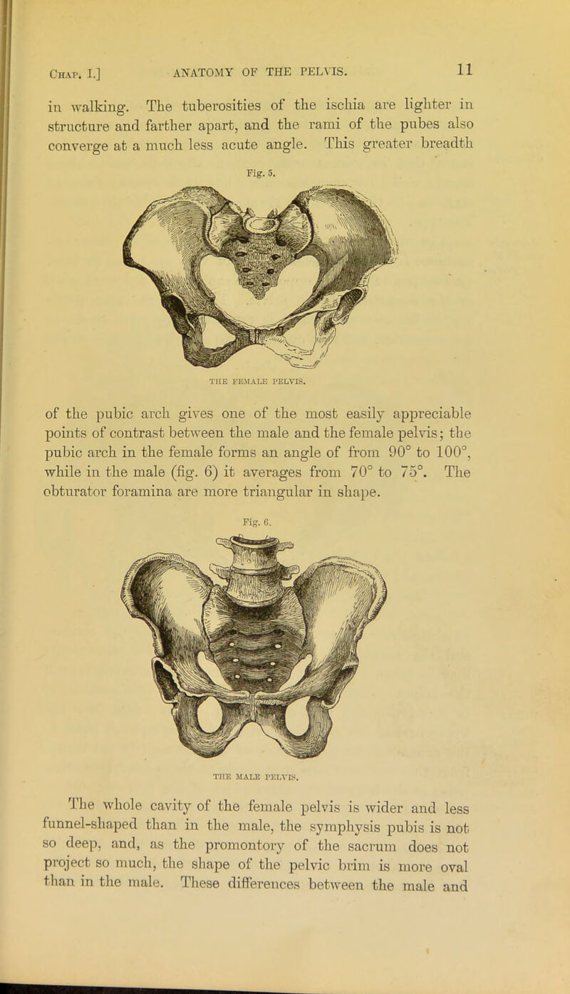 in walking. The tuberosities of the iscliia are lighter in structure and farther apart, and the rami of the pubes also converge at a much less acute angle. This greater breadth Fig. 5. THE FEMALE PEL^rrS. of the pubic arch gives one of the most easily appreciable points of contrast between the male and the female pelvis; the pubic arch in the female forms an angle of from 90° to 100°, while in the male (fig. 6) it averages from 70° to 75°. The obturator foramina are more triangular in shape. Fig. e. THE MALE PELVIS. The whole cavity of the female pelvis is wider and less funnel-shaped than in the male, the symphysis pubis is not so deep, and, as the promontory of the sacrum does not project so much, the shape of the pelvic brim is more oval than in the male. These differences between the male and