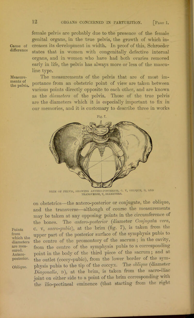 Cause of difference Measure- ments of the pelvis. Points from which the diameters are mea- sured. Antero- posterior. Oblique. femtile pelvis are probably due to the presence of the female genital organs, in the true pelvis, the growth of which in- creases its development in width. In proof of this, Schroeder states that in women with congenitally defective internal organs, and in women who liave had both ovaries removed early in life, the pelvis has always more or less of the mascu- line type. The measurements of the pelvis that are of most im- portance from an obstetric point of view are taken between various points directly opposite to each other, and are known as the diameters of the pelvis. Those of the true pelvis are the diameters which it is especially important to fix in our memories, and it is customary to describe three in works Pig. r. Uimi OF PELVIS, S1IOW1.N-G A.\TERO-POS'naU01l, C. V, OELIQITK, I), -A-ND TEANSVBRSB, T, DIAilBTBaS. on obstetrics—the antero-posterior or conjugate, the oblique, and the transverse—although of course the measurements may be taken at any opposing points in the circumference of the bones. The antero-posterior (diameter Gonjugata rera, C. V, sacro-pniiic), at the brim (fig. 7), is taken from the upper part of the posterior surface of the symphysis pubis to the centre of the promontory of the sacrum; in the cavity, from the centre of the symphysis pubis to a corresponding point in the body of the third piece of the sacrum; and at the outlet (coccy-pubic), from the lower border of the sym- physis pubis to the tip of the coccyx. Ihe ohligue (diametei Biagonalis, n), at the brim, is taken from the sacro-iliac joint on either side to a point of the brim corresponding a\ ith the ilio-pectineal eminence (that starting from the right