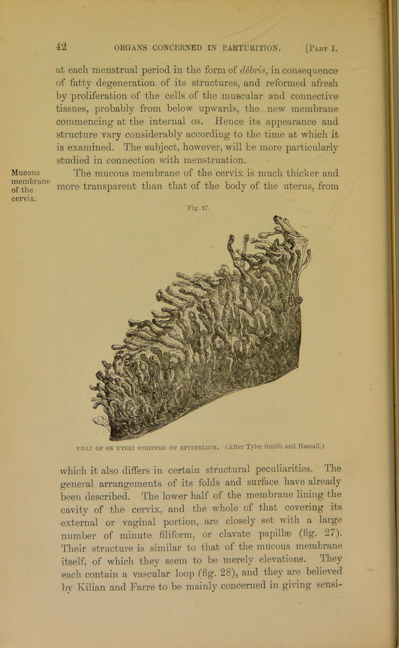 Mucous membrane of the cervix. at each niensti’ual period in the form of debiin, in consequence of fatty degeneration of its structures, and reformed afresh by proliferation of the cells of the muscular and connective tissues, probably from below upwards, the new membrane commencing at the internal os. Hence its appearance and structure vary considerably according to the time at which it is examined. The subject, however, will be more particularly studied in connection with menstruation. The mucous membrane of the cervix is much thicker and more transparent than that of the body of the uterus, from Fig. 27. vii.i.i OP os UTER[ STilirpED OP EPITHELU7.M. CAftcr Tvlci' Smith au(l Hassall.) which it also diffex’S in certain structui’al peculiaiuties. The general arrangements of its folds and surface have already been described, 'hhe lower half of the membrane lining the cavity of the cei’vix, and the whole of that covering its external or vaginal portion, ai’e closely set with a lai’ge number of minute filiform, or clavate papillm (fig. 27). 4.^1ieir structure is similar to tliat of the nxucous membi’ane itself, of whicli they seem to be mei’ely elevations. Ihey eaclx contain a vascular loop (fig. 28), and they are believed by Kilian and Farre to be mainly concerned in giving sensi-