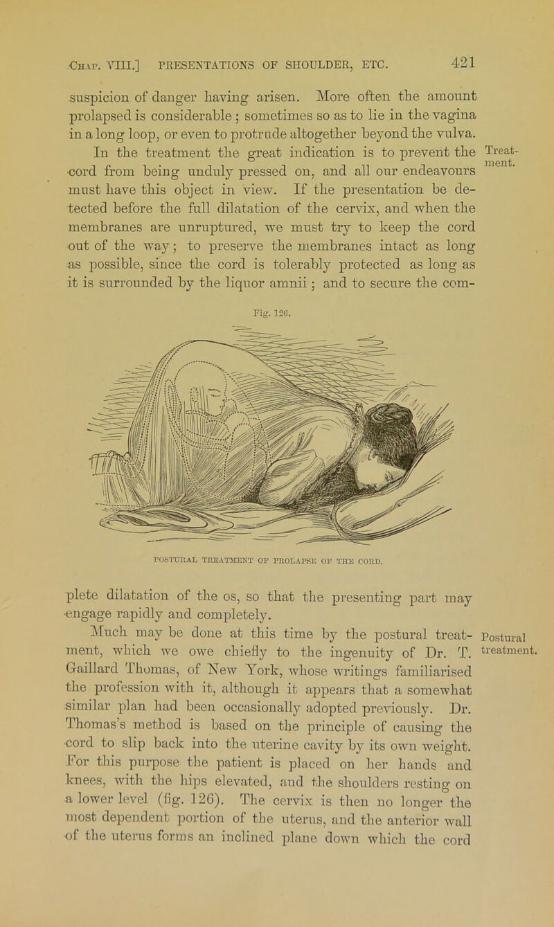 suspicion of danger having arisen. ]\Iore often the amount prolapsed is considerable; sometimes so as to lie in the vagina in a long loop, or even to protrude altogether beyond the vulva. In the treatment the great indication is to prevent the •cord from being unduly pressed on, and all our endeavours must have this object in view. If the presentation be de- tected before the full dilatation of the cervix, and when the membranes are unruptured, we must try to keep the cord out of the way; to preserve the membranes intact as long as possible, since the cord is tolerably protected as long as it is surrounded by the liquor amnii; and to secure the corn- rig. 12G. rOSTDIUO, THBATMENT OP PROLAPSE OP THE CORD. plete dilatation of the os, so that the presenting part may •engage rapidly and completely. Much may be done at this time by the postural ti’eat- ment, which we owe chiefly to the ingenuity of Dr. T. Gaillard Thomas, of New York, whose writings familiarised the profession with it, although it appears that a somewhat similar plan had been occasionally adopted previously. Dr. Thomas’s method is based on the principle of causing the •cord to slip back into the uterine cavity by its own weight. JYr this puiqoose the patient is placed on her hands and knees, with the hips elevated, and the shoulders resting on a lower level (fig. 12G). The cervix is then no longer the most dependent portion of the uterus, and the anterior wall of the uterus forms an inclined plane down which the cord Treat- ment. Postural treatment.