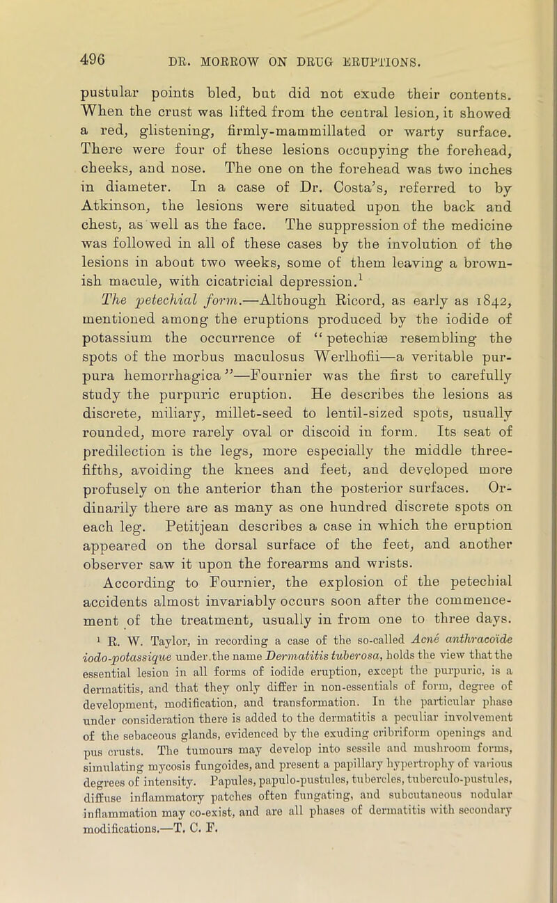 pustular points bled, but did not exude their contents. When the crust was lifted from the ceutral lesion, it showed a red, glistening, firmly-mammillated or warty surface. There were four of these lesions occupying the forehead, cheeks, and nose. The one on the forehead was two inches in diameter. In a case of Dr. Costa’s, referred to by Atkinson, the lesions were situated upon the back and chest, as well as the face. The suppression of the medicine was followed in all of these cases by the involution of the lesions in about two weeks, some of them leaving a brown- ish macule, with cicatricial depression.^ The petechial form.—Although Ricord, as early as 1842, mentioned among the eruptions produced by the iodide of potassium the occurrence of “ petechia resembling the spots of the morbus maculosus Werlhofii—a veritable pur- pura hemorrhagica”—Fournier was the first to carefully study the purpuric eruption. He describes the lesions as discrete, miliary, millet-seed to lentil-sized spots, usually rounded, more rarely oval or discoid in form. Its seat of predilection is the legs, more especially the middle three- fifths, avoiding the knees and feet, and developed more profusely on the anterior than the posterior surfaces. Or- dinarily there are as many as one hundred discrete spots on each leg. Petitjean describes a case in which the eruption appeared on the dorsal surface of the feet, and another observer saw it upon the forearms and wrists. According to Fournier, the explosion of the petechial accidents almost invariably occurs soon after the commence- ment of the treatment, usually in from one to three days. * R. W. Taylor, in recording a case of the so-called Acne anthracolde iodo-potassique under.the name Dermatitis tuberosa, holds the view that the essential lesion in all forms of iodide eruption, except the purpuric, is a dermatitis, and that they only differ in non-essentials of form, degree of development, modification, and transformation. In the paidicular phase under consideration there is added to the dermatitis a peculiar involvement of the sebaceous glands, evidenced by the exuding cribriform openings and pus crusts. The tumours may develop into sessile and mushroom forms, simulating mycosis fungoides, and present a papillary hypertrophy of various degrees of intensity. Papules, papulo-pustules, tubercles, tuberculo-pustules, diffuse inflammatory patches often fungating, and subcutaneous nodular inflammation may co-exist, and are all phases of dermatitis with secondary modifications.—T. C. P.