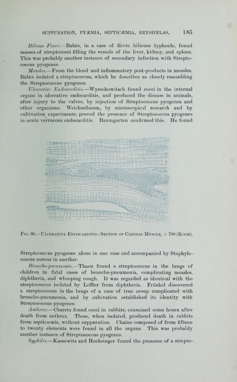 Bilious Fever.—Babes, in a case of fievre bilieuse typhoide, found masses of streptococci filling the vessels of the liver, kidney, and spleen. This was probably another instance of secondary infection with Strepto- coccus pyogenes. Measles.—From the blood and inflammatory post-products in measles, Babes isolated a streptococcus, which he describes as closely resembling the Streptococcus pyogenes. Ulcerative Endocarditis.—Wyssokowitsch found cocci in the internal organs in ulcerative endocarditis, and produced the disease in animals, after injury to the valves, by injection of Streptococcus pyogenes and other organisms. Weichselbaum, by microscopical research and by cultivation experiments, proved the presence of Streptococcus pyogenes in acute verrucous endocarditis. Baumgarten confirmed this. He found Fig. 86.—Ulcerative Endocarditis : Section of Cardiac Muscle, x 700 (Koch). Streptococcus pyogenes alone in one case and accompanied by Staphylo- coccus aureus in another. Broncho-pneumonia.—Thaon found a streptococcus in the lungs of children in fatal cases of broncho-pneumonia, complicating measles, diphtheria, and whooping cough. It was regarded as identical with the streptococcus isolated by LofHer from diphtheria. Frankel discovered a streptococcus in the lungs of a case of true croup complicated with broncho-pneumonia, and by cultivation established its identity with Streptococcus pyogenes. Anthrax.—Charrin found cocci in rabbits, examined some hours after death from anthrax. These, when isolated, produced death in rabbits from septicaemia, without suppuration. Chains composed of from fifteen to twenty elements were found in all the organs. This was probably another instance of Streptococcus pyogenes. Syphilis.—Kassowitz and Hochsinger found the presence of a strepto-