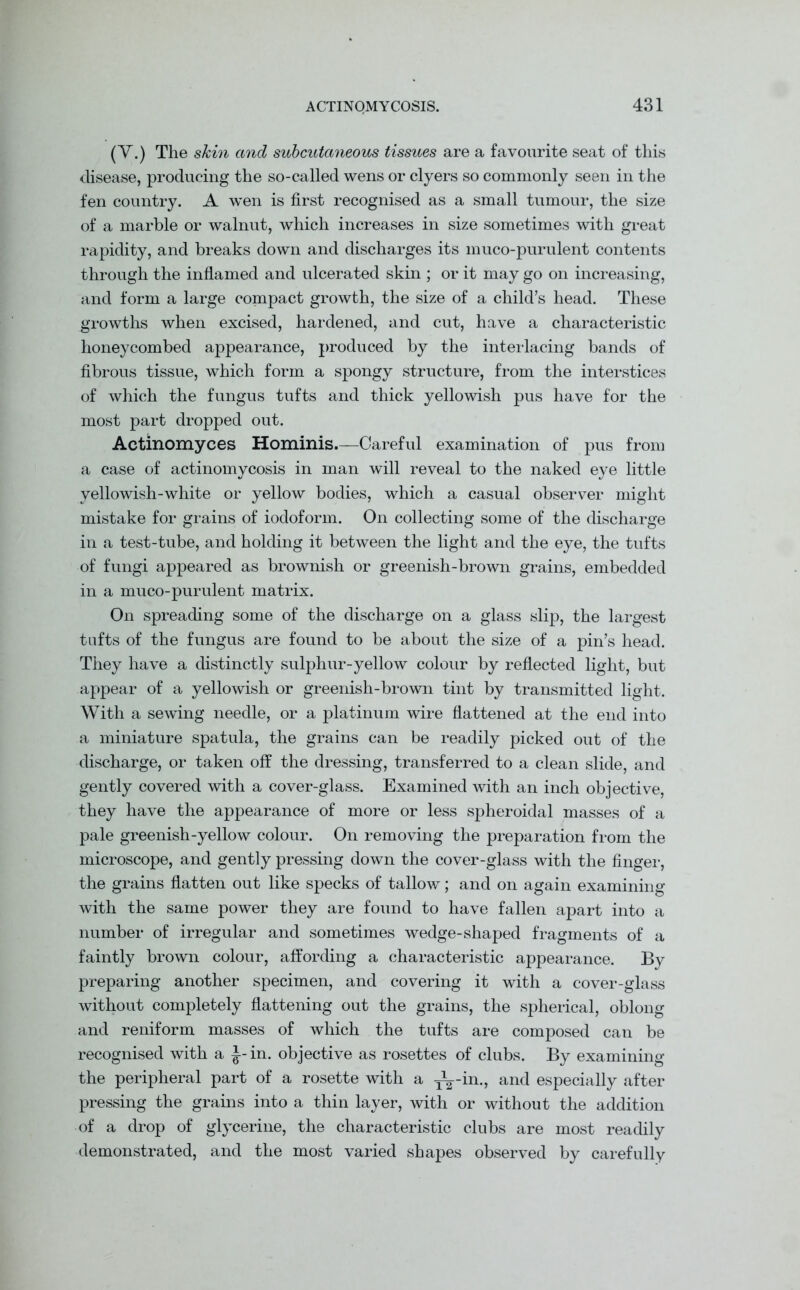(V.) The skin and subcutaneous tissues are a favourite seat of this disease, producing the so-called wens or dyers so commonly seen in the fen country. A wen is first recognised as a small tumour, the size of a marble or walnut, which increases in size sometimes with great rapidity, and breaks down and discharges its muco-purulent contents through the inflamed and ulcerated skin ; or it may go on increasing, and form a large compact growth, the size of a child’s head. These growths when excised, hardened, and cut, have a characteristic honeycombed appearance, produced by the interlacing bands of fibrous tissue, which form a spongy structure, from the interstices of which the fungus tufts and thick yellowish pus have for the most part dropped out. Actinomyces Hominis.—Careful examination of pus from a case of actinomycosis in man will reveal to the naked eye little yellowish-white or yellow bodies, which a casual observer might mistake for grains of iodoform. On collecting some of the discharge in a test-tube, and holding it between the light and the eye, the tufts of fungi appeared as brownish or greenish-brown grains, embedded in a muco-purulent matrix. On spreading some of the discharge on a glass slip, the largest tufts of the fungus are found to be about the size of a pin’s head. They have a distinctly sulphur-yellow colour by reflected light, but appear of a yellowish or greenish-brown tint by transmitted light. With a sewing needle, or a platinum wire flattened at the end into a miniature spatula, the grains can be readily picked out of the discharge, or taken off the dressing, transferred to a clean slide, and gently covered with a cover-glass. Examined with an inch objective, they have the appearance of more or less spheroidal masses of a pale greenish-yellow colour. On removing the preparation from the microscope, and gently pressing down the cover-glass with the finger, the grains flatten out like specks of tallow; and on again examining with the same power they are found to have fallen apart into a number of irregular and sometimes wedge-shaped fragments of a faintly brown colour, affording a characteristic appearance. By preparing another specimen, and covering it with a cover-glass without completely flattening out the grains, the spherical, oblong and reniform masses of which the tufts are composed can be recognised with a J-in. objective as rosettes of clubs. By examining the peripheral part of a rosette with a j^-in., and especially after pressing the grains into a thin layer, with or without the addition of a drop of glycerine, the characteristic clubs are most readily demonstrated, and the most varied shapes observed by carefully