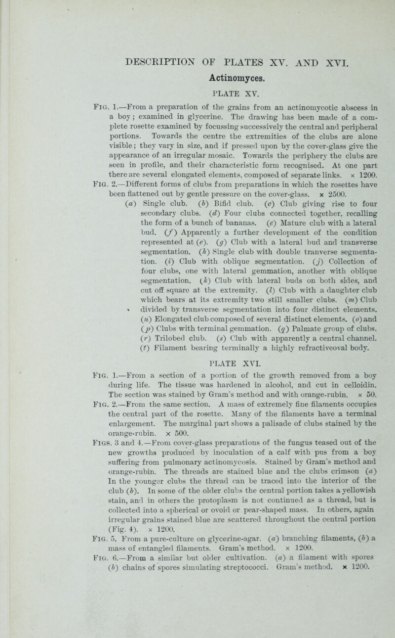 DESCRIPTION OF PLATES XV. AND XVI. Actinomyces. PLATE XV. Fig. 1.—From a preparation of the grains from an actinomycotic abscess in a boy; examined in glycerine. The drawing has been made of a com- plete rosette examined by focussing successively the central and peripheral portions. Towards the centre the extremities of the clubs are alone visible; they vary in size, and if pressed upon by the cover-glass give the appearance of an irregular mosaic. Towards the periphery the clubs are seen in profile, and their characteristic form recognised. At one part there are several elongated elements, composed of separate links, x 1200. Fig. 2.—Different forms of clubs from preparations in which the rosettes have been flattened out by gentle pressure on the cover-glass, x 2500. (a) Single club. (b) Bifid club. (c) Club giving rise to four secondary clubs. (d) Four clubs connected together, recalling the form of a bunch of bananas, (e) Mature club with a lateral bud. (/) Apparently a further development of the condition represented at (e). (g) Club with a lateral bud and transverse segmentation. (k) Single club with double tranverse segmenta- tion. (i) Club with oblique segmentation, (j) Collection of four clubs, one with lateral gemmation, another with oblique segmentation. (&) Club with lateral buds on both sides, and cut off square at the extremity. (l) Club with a daughter club which bears at its extremity two still smaller clubs, (ni) Club « divided by transverse segmentation into four distinct elements. (ti) Elongated club composed of several distinct elements, (o)and (jtf) Clubs with terminal gemmation, (q) Palmate group of clubs. (r) Trilobed club, (s) Club with apparently a central channel. (t) Filament bearing terminally a highly refractiveoval body. PLATE XYI. Fig. 1.—From a section of a portion of the growth removed from a boy during life. The tissue was hardened in alcohol, and cut in celloidin. The section was stained by Gram’s method and with orange-rubin. x 50. Fig. 2.—From the same section. A mass of extremely fine filaments occupies the central part of the rosette. Many of the filaments have a terminal enlargement. The marginal part shows a palisade of clubs stained by the orange-rubin. x 500. Figs. 3 and 4.—From cover-glass preparations of the fungus teased out of the new growths produced by inoculation of a calf with pus from a boy suffering from pulmonary actinomycosis. Stained by Gram’s method and orange-rubin. The threads are stained blue and the clubs crimson (a) In the younger clubs the thread can be traced into the interior of the club (b). In some of the older clubs the central portion takes a yellowish stain, and in others the protoplasm is not continued as a thread, but is collected into a spherical or ovoid or pear-shaped mass. In others, again irregular grains stained blue are scattered throughout the central portion (Fig. 4). x 1200. Fig. 5. From a pure-culture on glycerine-agar, (a) branching filaments, (b) a mass of entangled filaments. Gram’s method, x 1200. Fig. 6.—From a similar but older cultivation, (a) a filament with spores (&) chains of spores simulating streptococci. Gram’s method, x 1200.