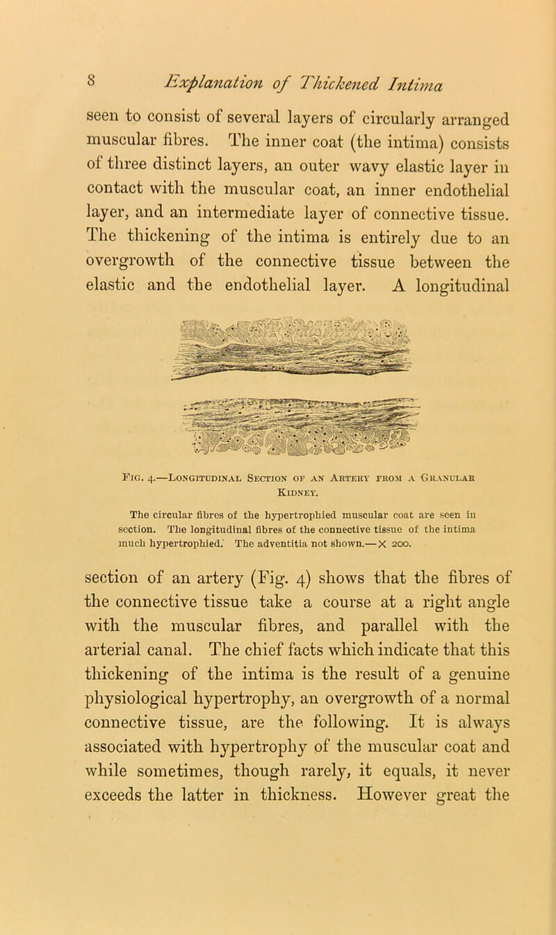 Explanation of Thickened Intima seen to consist of several layers of circularly arranged muscular fibres. The inner coat (the intima) consists of three distinct layers, an outer wavy elastic layer in contact with the muscular coat, an inner endothelial layer, and an intermediate layer of connective tissue. The thickening of the intima is entirely due to an overgrowth of the connective tissue between the elastic and the endothelial layer. A longitudinal Fig. 4.—LoNGiTDDiNAii Section of an Artery from a Oranular Kidney. Tlie circular fibres of the hypertrophied muscular coat are seen in section. The longitudinal fibres of the connective tissue of the intima much hypertrophied.' The adventitia not shown.—X 200. section of an artery (Fig. 4) shows that the fibres of the connective tissue take a course at a right angle with the muscular fibres, and parallel with the arterial canal. The chief facts which indicate that this thickening of the intima is the result of a genuine physiological hypertrophy, an overgrowth of a normal connective tissue, are the following. It is always associated with h}''pertrophy of the muscular coat and while sometimes, though rarely, it equals, it never exceeds the latter in thickness. However great the