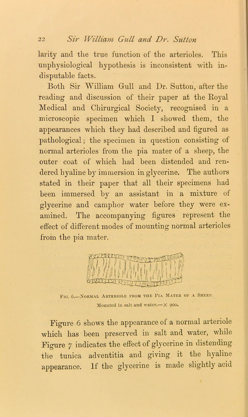 larity and the true function of the arterioles. This unphysiological hypothesis is inconsistent with in- disputable facts. Both Sir William Gull and Dr. Sutton, after the reading and discussion of their paper at the Eoyal Medical and Chirurgical Society, recognised in a microscopic specimen which I showed them, the appearances which they had described and figured as pathological; the specimen in question consisting of normal arterioles from the pia mater of a sheep, the outer coat of which had been distended and ren- dered hyaline by immersion in glycerine. The authors stated in their paper that all their specimens had been immersed by an assistant in a mixture of glycerine and camphor water before they were ex- amined. The accompanying figures represent the effect of different modes of mounting normal arterioles from the pia mater. Figure 6 shows the appearance of a normal arteriole which has been preserved in salt and water, while Figure 7 indicates the effect of glycerine in distending the tunica adventitia and giving it tlie hyaline appearance. If the glycerine is made slightly acid Fig. 6. Xorm^Uj Arteriole from the Pia Mater of a Sheer. Mounted in salt and water.— X 200.