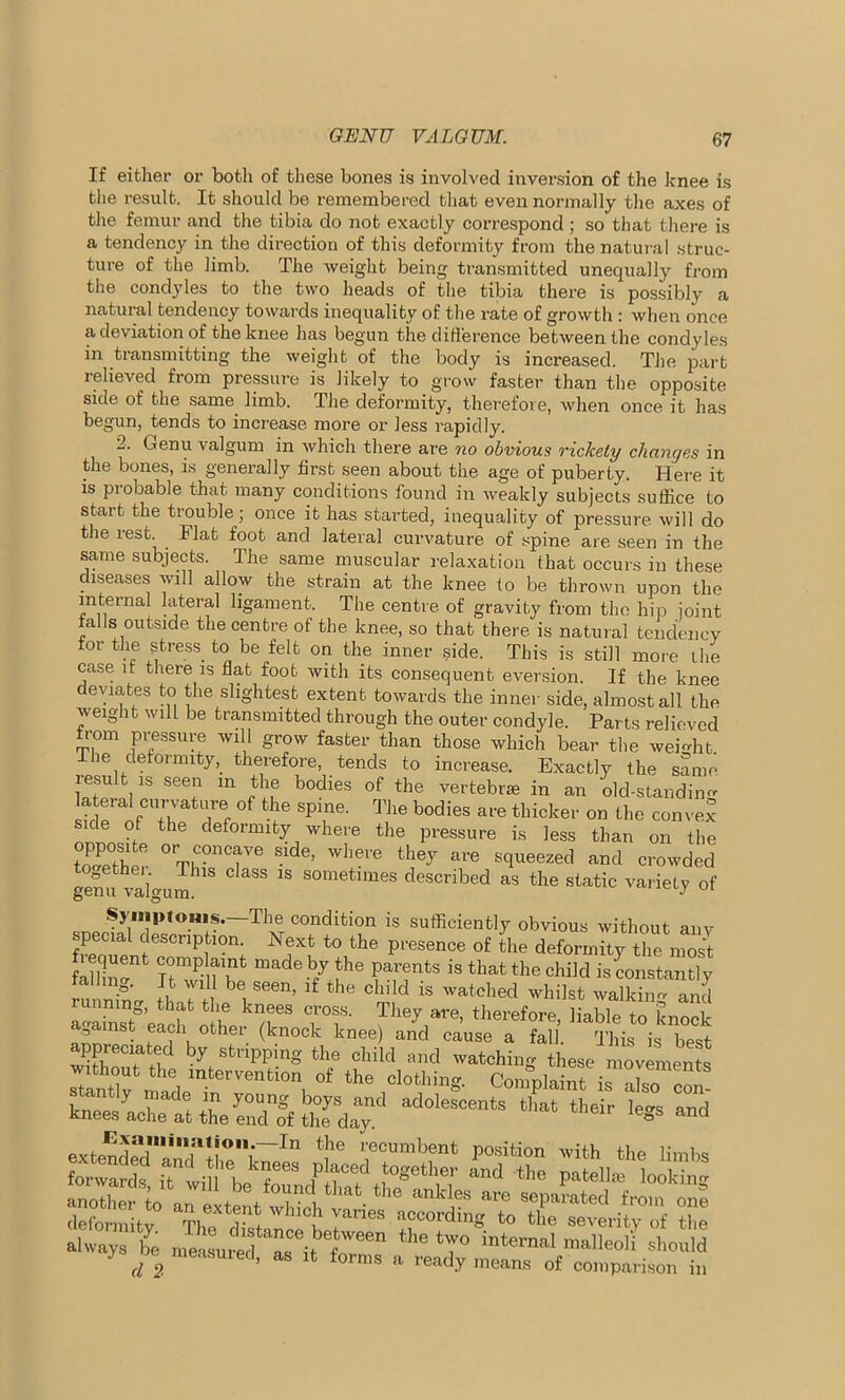 If either or both of these bones is involved inversion of the knee is the result. It should be remembered that even normally the axes of the femur and the tibia do not exactly correspond ; so that there is a tendency in the direction of this deformity from the natural struc- ture of the limb. The weight being transmitted unequally from the condyles to the two heads of the tibia there is possibly a natural tendency towards inequality of the rate of growth : when once a deviation of the knee has begun the difference between the condyles in transmitting the weight of the body is increased. The part lelieved from pressure is likely to grow faster than the opposite side of the same limb. The deformity, therefore, when once it has begun, tends to increase more or less rapidly. ■ Genu valgum in which there are no obvious rickety changes in the bones, is generally first seen about the age of puberty. Here it is probable that many conditions found in weakly subjects suffice to start the trouble; once it has started, inequality of pressure will do the rest. Flat foot and lateral curvature of spine are seen in the same subjects. The same muscular relaxation that occurs in these diseases will allow the strain at the knee to be thrown upon the internal lateral ligament. The centre of gravity from the hip joint falls outside the centre of the knee, so that there is natural tendency for the stress, to be felt on the inner side. This is still more the case it there is flat foot with its consequent eversion. If the knee deviates to the slightest extent towards the inner side, almost all the weight will be transmitted through the outer condyle. Parts relieved from pressure will grow faster than those which bear the weight The deformity, therefore, tends to increase. Exactly the same lesult is seen m the bodies of the vertebne in an old-standing rlrL‘ I', a* S<T' TJ“ b°die5 thicker on the convex side of the deformity where the pressure is less than on the Wher IhT BMe' Wl“ra squeezed and crowded gemi valgum ‘S Sometlmes described as the static variety of Symptoms. The condition is sufficiently obvious without anv special description. Next to the presence of the deformity the m ”s‘ J r J°mp- nnt n“de ?e parentls is that the °WM is constantly falling. It will be seen, if the child is watched whilst walking and ZfasT'efcf ‘ h kT T°f' Tl,ey «. ‘before, to knock ,amst each other (knock knee) and cause a fall. This is best S“d by stripping the child and watching these movemeS Sv made” °f ‘he °l0“'i1’*- C°'“Plai‘ is also con kneesicrtSeSlfhTd™’ ** ^ ad extend“dn,amr!l ent~In ^ r1ecumbent position with the limbs forwards it til b J>l?Ced f°Sether and the patellm looking S 0 an 1 “tentSitf'tHe anlt6S ^ SePa-ted from one deformity ti i ! J vanes according to the severity of the always be ^ *1° internal malleoli should y d \ me<lsulecl> as lfc forms a ready means of comparison in