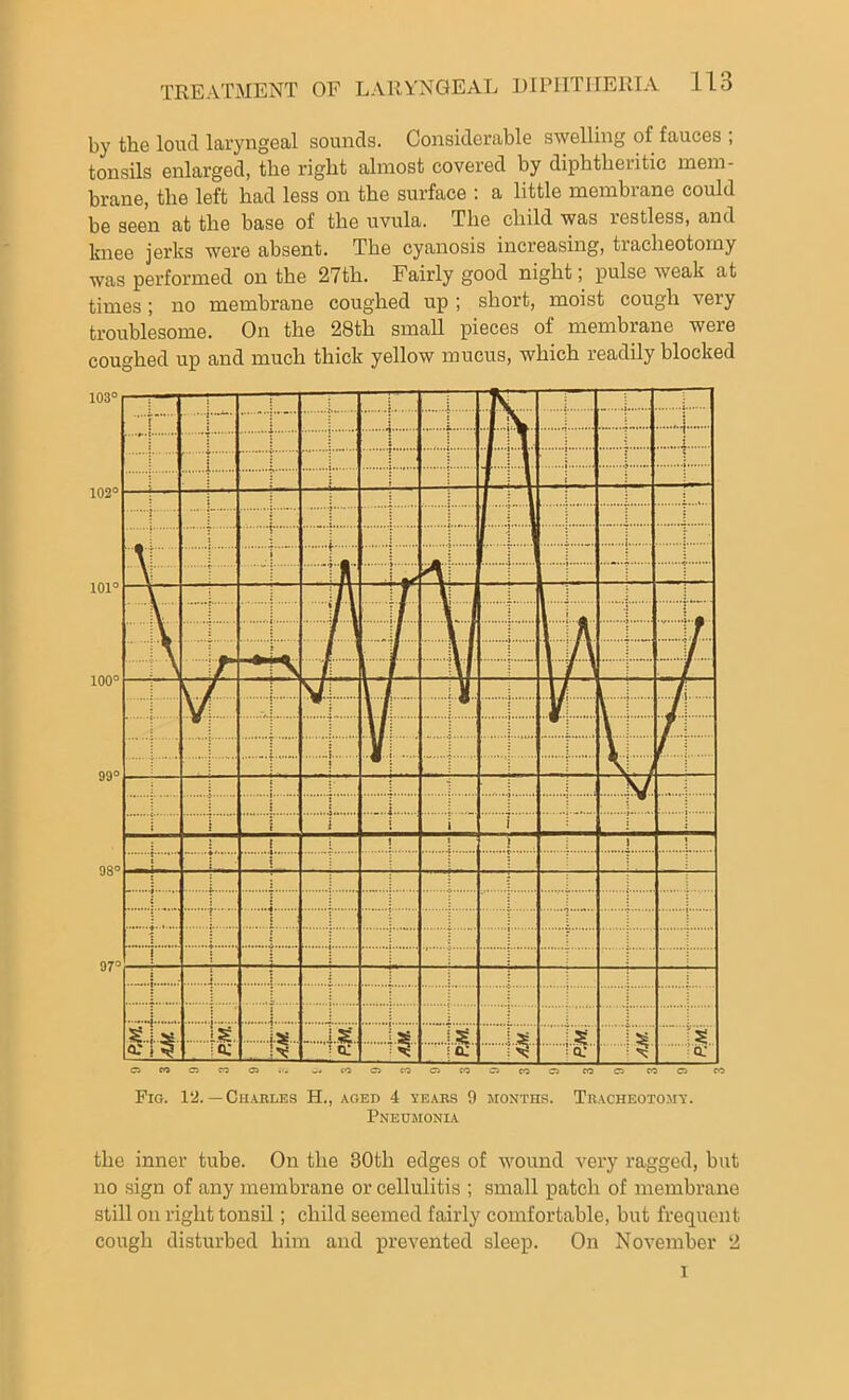 by the loud laryngeal sounds. Considerable swelling of fauces ; tonsils enlarged, the right almost covered by diphtheritic mem- brane, the left had less on the surface : a little membrane could be seen at the base of the uvula. The child was restless, and knee jerks were absent. The cyanosis increasing, tracheotomy was performed on the 27th. Fairly good night; pulse weak at times; no membrane coughed up ; short, moist cough very troublesome. On the 28th small pieces of membrane were coughed up and much thick yellow mucus, which readily blocked Fig. 12. — Charles H., aged 4 years 9 months. Tracheotomy. Pneumonia the inner tube. On the 30th edges of wound very ragged, but no sign of any membrane or cellulitis ; small patch of membrane still on right tonsil; child seemed fairly comfortable, but frequent cough disturbed him and prevented sleep. On November 2 i