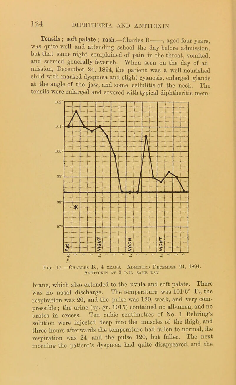 Tonsils ; soft palate ; rash.—Charles B , aged four years, was quite well and attending school the day before admission, but that same night complained of pain in the throat, vomited, and seemed generally feverish. When seen on the day of ad- mission, December 24, 1894, the patient was a well-nourished child with marked dyspnoea and slight cyanosis, enlarged glands at the angle of the jaw, and some cellulitis of the neck. The tonsils were enlarged and covered with typical diphtheritic mem- AnTITOXIN AT 3 P. M. SAME DAY brane, which also extended to the uvula and soft palate. There was no nasal discharge. The temperature was 101-6° F., the respiration was 20, and the pulse was 120, weak, and very com- pressible ; the urine (sp. gr. 1015) contained no albumen, and no urates in excess. Ten cubic centimetres of No. 1 Behring’s solution were injected deep into the muscles of the thigh, and three hours afterwards the temperature had fallen to normal, the respiration was 24, and the pulse 120, but fuller. The next morning the patient’s dyspnoea had quite disappeared, and the