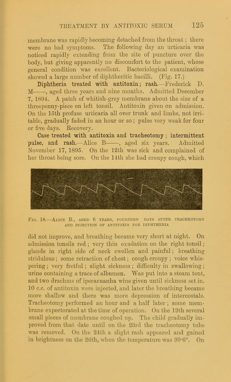 membrane was rapidly becoming detached from the throat; there were no bad symptoms. The following day an urticaria was noticed rapidly extending from the site of puncture over the body, but giving apparently no discomfort to the patient, whose general condition was excellent. Bacteriological examination showed a large number of diphtheritic bacilli. (Fig. 17.) Diphtheria treated with antitoxin; rash.—Frederick D. M , aged three years and nine months. Admitted December 7, 1894. A patch of whitish-grey membrane about the size of a threepenny-piece on left tonsil. Antitoxin given on admission. On the 15th profuse urticaria all over trunk and limbs, not irri- table, gradually faded in an hour or so ; pulse very weak for four or five days. Recovery. Case treated with antitoxin and tracheotomy ; intermittent pulse, and rash.—Alice B , aged six years. Admitted November 17, 1895. On the 12th was sick and complained of her throat being sore. On the 14th she had croupy cough, which Fig. 18.—Alice B., aged 6 years, fourteen days after tracheotomy AND INJECTION OF ANTITOXIN FOR DIPHTHERIA did not improve, and breathing became very short at night. On admission tonsils red ; very thin exudation on the right tonsil; glands in right side of neck swollen and painful; breathing stridulous ; some retraction of chest; cough croupy ; voice whis- pering ; very fretful; slight sickness ; difficulty in swallowing ; urine containing a trace of albumen. Was put into a steam tent, and two drachms of ipecacuanha wine given until sickness set in. 10 c.c. of antitoxin were injected, and later the breathing became more shallow and there was more depression of intercostals. Tracheotomy performed an hour and a half later ; some mem- brane expectorated at the time of operation. On the 19tli several small pieces of membrane coughed up. The child gradually im- proved from that date until on the 23rd the tracheotomy tube was removed. On the 24th a slight rash appeared and gained in brightness on the 2Gth, when the temperature was 99-G°. On