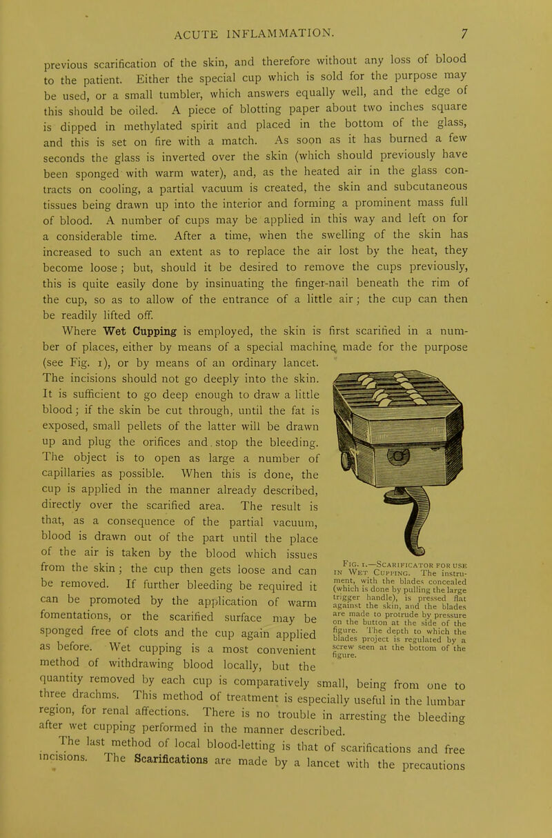 previous scarification of the skin, and therefore without any loss of blood to the patient. Either the special cup which is sold for the purpose may be used, or a small tumbler, which answers equally well, and the edge of this should be oiled. A piece of blotting paper about two inches square is dipped in methylated spirit and placed in the bottom of the glass, and this is set on fire with a match. As soon as it has burned a few seconds the glass is inverted over the skin (which should previously have been sponged with warm water), and, as the heated air in the glass con- tracts on cooling, a partial vacuum is created, the skin and subcutaneous tissues being drawn up into the interior and forming a prominent mass full of blood. A number of cups may be applied in this way and left on for a considerable time. After a time, when the swelling of the skin has increased to such an extent as to replace the air lost by the heat, they become loose; but, should it be desired to remove the cups previously, this is quite easily done by insinuating the finger-nail beneath the rim of the cup, so as to allow of the entrance of a little air; the cup can then be readily lifted off. Where Wet Cupping is employed, the skin is first scarified in a num- ber of places, either by means of a special machine made for the purpose (see Fig. i), or by means of an ordinary lancet. The incisions should not go deeply into the skin. It is sufficient to go deep enough to draw a little blood; if the skin be cut through, until the fat is exposed, small pellets of the latter will be drawn up and plug the orifices and. stop the bleeding. The object is to open as large a number of capillaries as possible. When this is done, the cup is applied in the manner already described, directly over the scarified area. The result is that, as a consequence of the partial vacuum, blood is drawn out of the part until the place of the air is taken by the blood which issues from the skin ; the cup then gets loose and can be removed. If further bleeding be required it can be promoted by the application of warm fomentations, or the scarified surface may be sponged free of clots and the cup again applied as before. Wet cupping is a most convenient method of withdrawing blood locally, but the quantity removed by each cup is comparatively small, being from one to three drachms. This method of treatment is especially useful in the lumbar region, for renal affections. There is no trouble in arresting the bleedin^ after wet cupping performed in the manner described. I he last method of local blood-letting is that of scarifications and free incisions. The Scarifications are made by a lancet with the precautions Fig. i.—Scarificator for use in Wet Cuffing. The instru- ment, with the blades concealed (which is done by pulling the large trigger handle), is pressed flat against the skin, and the blades are made to protrude by pressure on the button at the side of the figure. The depth to which the blades project is regulated by a screw seen at the bottom of the figure.