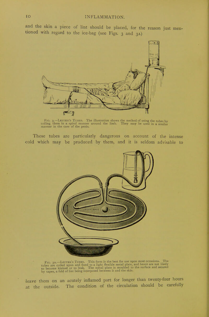 and the skin a piece of lint should be placed, for the reason just men- tioned with regard to the ice-bag (see Figs. 3 and 3A) Fig. 3.—Lexter's Tubes. The illustration shows the method of using the tubes by coiling them in a spiral manner around the limb. They may be used in a similar manner in the case of the penis. These tubes are particularly dangerous on account of the intense cold which may be produced by them, and it is seldom advisable to pIG ,a —Leitek’s Tubes. This form is the best for use upon most occasions, the tubes are coiled upon and fixed to a light flexible metal plate, and hence are not likely to become kinked or to leak. The metal plate is moulded to the surface and secured by tapes, a fold of lint being interposed between it and the skin. leave them on an acutely inflamed part for longer than twenty-four hours at the outside. The condition of the circulation should be carefully