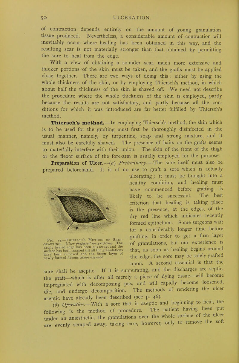 of contraction depends entirely on the amount of young granulation tissue produced. Nevertheless, a considerable amount of contraction will inevitably occur where healing has been obtained in this way, and the resulting scar is not materially stronger than that obtained by permitting the sore to heal from the edge. With a view of obtaining a sounder scar, much more extensive and thicker portions of the skin must be taken, and the grafts must be applied close together. There are two ways of doing this: either by using the whole thickness of the skin, or by employing Thiersch’s method, in which about half the thickness of the skin is shaved off. We need not describe the procedure where the whole thickness of the skin is employed, partly because the results are not satisfactory, and partly because all the con- ditions for which it was introduced are far better fulfilled by Thiersch’s method. Thiersch’s method.—In employing Thiersch’s method, the skin which is to be used for the grafting must first be thoroughly disinfected in the usual manner, namely, by turpentine, soap and strong mixture, and it must also be carefully shaved. The presence of hairs on the grafts seems to materially interfere with their union. The skin of the front of the thigh or the flexor surface of the fore-arm is usually employed for the purpose. Preparation of Ulcer.—(a) Preliminary.—The sore itself must also be prepared beforehand. It is of no use to graft a sore which is actually ulcerating; it must be brought into a healthy condition, and healing must have commenced before grafting is likely to be successful. The best criterion that healing is taking place is the presence, at the edges, of the dry red line which indicates recently formed epithelium. Some surgeons wait for a considerably longer time before grafting, in order to get a firm layer of granulations, but our experience is that, as soon as healing begins around the edge, the sore may be safely grafted upon. A second essential is that the sore shall be aseptic. If it is suppurating, and the discharges are septic, the graft—which is after all merely a piece of dying tissue will become impregnated with decomposing pus, and will rapidly become loosened, die, and undergo decomposition. The methods of rendering the ulcer aseptic have already been described (see p. 46)- (b) Operative.—With a sore that is aseptic and beginning to heal, the following is the method of procedure. The patient having been put under an anesthetic, the granulations over the whole surface of the ulcer Fig. 13.—Thiersch’s Method of Skin- grafting. Ulcer prepared for grafting. The newly healed edge has been cutaway, and the surface has been scraped till all the granulations have been removed and the firmer layer of newiy formed fibrous tissue exposed. are evenly scraped away, taking care, however, only to remove the soft