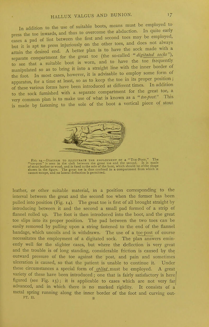 In addition to the use of suitable boots, means must be employed to press the toe inwards, and thus to overcome the abduction. In quite early cases a pad of lint between the first and second toes may be employed, Lt it is apt to press injuriously on the other toes, and does not always attain the desired end. A better plan is to have the sock made with a separate compartment for the great toe (the so-called ), to^see that a suitable boot is worn, and to have the toe frequently manipulated so as to bring it into a straight line with the inner border of the foot. In most cases, however, it is advisable to employ some form of apparatus, for a time at least, so as to keep the toe in its proper position; of these various forms have been introduced at different times. In addition to the sock furnished with a separate compartment for the great toe, a very common plan is to make use of what is known as a “ toe-post:'' This is made by fastening to the sole of the boot a vertical piece of stout Fig. 14.—Diagram to illustrate the employment of a “Toe-Post.’ The “toe*post” is seen in the cleft between the great toe and the second. It is made of stout leather or wood, and is fixed to the sole of the boot, which should be of the shape shown in the figure. The great toe is thus confined in a compartment from which it cannot escape, and no lateral deflection is permitted. leather, or other suitable material, in a position corresponding to the interval between the great and the second toe when the former has been pulled into position (Fig. 14). The great toe is first of all brought straight by introducing between it and the second a small pad formed of a strip of flannel rolled up. The foot is then introduced into the boot, and the great toe slips into its proper position. The pad between the two toes can be easily removed by pulling upon a string fastened to the end of the flannel bandage, which uncoils and is withdrawn. The use of a toe-post of course necessitates the employment of a digitated sock. The plan answers emin- ently well for the slighter cases, but where the deflection is very great and the trouble is of long standing, considerable friction is caused by the outward pressure of the toe against the post, and pain and sometimes ulceration is caused, so that the patient is unable to continue it. Under these circumstances a special form of splint must be employed. A great variety of these have been introduced; one that is fairly satisfactory is here figured (see Fig. 15); it is applicable to cases which are not very far advanced, and in which there is no marked rigidity. It consists of a metal spring running along the inner border of the foot and curving out- PT. II. B