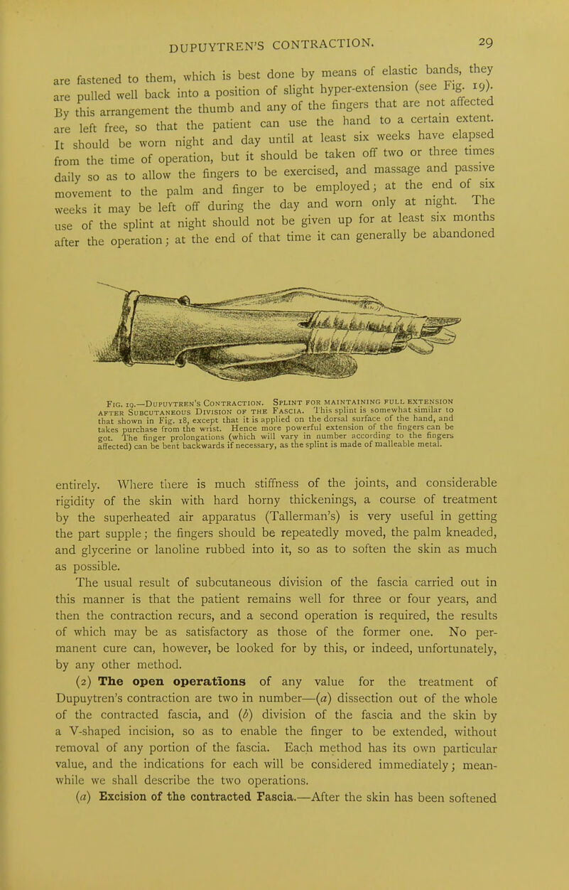 are fastened to them, which is best done by means of elastic bands, they are pulled well back into a position of slight hyper-extension (see Fig_ 19X By this arrangement the thumb and any of the fingers that are not affected are left free, so that the patient can use the hand to a certain extent. It should be worn night and day until at least six weeks have elapsed from the time of operation, but it should be taken off two or three times daily so as to allow the fingers to be exercised, and massage and passive movement to the palm and finger to be employed j at the end of six weeks it may be left off during the day and worn only at night, ihe use of the splint at night should not be given up for at least six months after the operation; at the end of that time it can generally be abandoned Fig. ig.—Dupuytren’s Contraction. Splint for maintaining full extension AFTER Subcutaneous Division of the Fascia. This splint is somewhat similar to that shown in Fig. i8, except that it is applied on the dorsal surface of the hand, and takes purchase from the wrist. Hence more powerful extension of the fingers can be got. The finger prolongations (which will vary in number according to the fingers affected) can be bent backwards if necessary, as the splint is made of malleable metal. entirely. Where there is much stiffness of the joints, and considerable rigidity of the skin with hard horny thickenings, a course of treatment by the superheated air apparatus (Tallerman’s) is very useful in getting the part supple; the fingers should be repeatedly moved, the palm kneaded, and glycerine or lanoline rubbed into it, so as to soften the skin as much as possible. The usual result of subcutaneous division of the fascia carried out in this manner is that the patient remains well for three or four years, and then the contraction recurs, and a second operation is required, the results of which may be as satisfactory as those of the former one. No per- manent cure can, however, be looked for by this, or indeed, unfortunately, by any other method. (2) The open operations of any value for the treatment of Dupuytren’s contraction are two in number—(a) dissection out of the whole of the contracted fascia, and {b) division of the fascia and the skin by a V-shaped incision, so as to enable the finger to be extended, without removal of any portion of the fascia. Each method has its own particular value, and the indications for each will be considered immediately; mean- while we shall describe the two operations. {a) Excision of the contracted Fascia.—After the skin has been softened