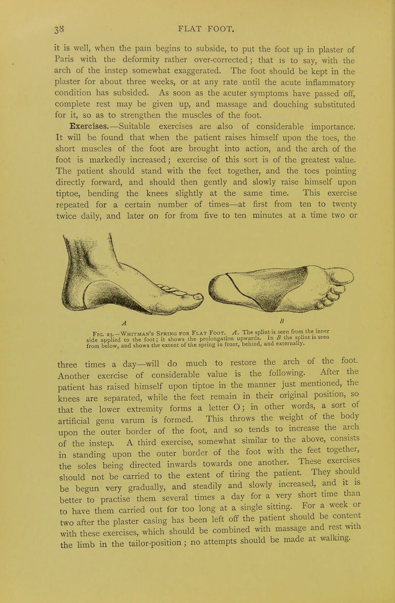it is well, when the pain begins to subside, to put the foot up in plaster of Paris with the deformity rather over-corrected; that is to say, with the arch of the instep somewhat exaggerated. The foot should be kept in the plaster for about three weeks, or at any rate until the acute inflammatory condition has subsided. As soon as the acuter symptoms have passed off, complete rest may be given up, and massage and douching substituted for it, so as to strengthen the muscles of the foot. Exercises.—Suitable exercises are also of considerable importance. It will be found that when the patient raises himself upon the toes, the short muscles of the foot are brought into action, and the arch of the foot is markedly increased; exercise of this sort is of the greatest value. The patient should stand with the feet together, and the toes pointing directly forward, and should then gently and slowly raise himself upon tiptoe, bending the knees slightly at the same time. This exercise repeated for a certain number of times—at first from ten to twenty twice daily, and later on for from five to ten minutes at a time two or Fig. 23.—Whitman’s Spring for Flat Foot. A. The splint is seen from the inner side applied to the foot; it shows the prolongation upwards. In B the splint is seen from below, and shows the extent of the spring in front, behind, and externally. three times a day—will do much to restore the arch of the foot. Another exercise of considerable value is the following. After the patient has raised himself upon tiptoe in the manner just mentioned, the knees are separated, while the feet remain in their original position, so that the lower extremity forms a letter O; in other words, a sort of artificial genu varum is formed. This throws the weight of the body upon the outer border of the foot, and so tends to increase the arch of the instep. A third exercise, somewhat similar to the above, consists in standing upon the outer border of the foot with the feet togethei, the soles being directed inwards towards one another. These exercises should not be carried to the extent of tiring the patient. They should be begun very gradually, and steadily and slowly increased, and it is better to practise them several times a day for a very short time than to have them carried out for too long at a single sitting. For a week or two after the plaster casing has been left off the patient should be content with these exercises, which should be combined with massage and lest with the limb in the tailor-position; no attempts should be made at walking.