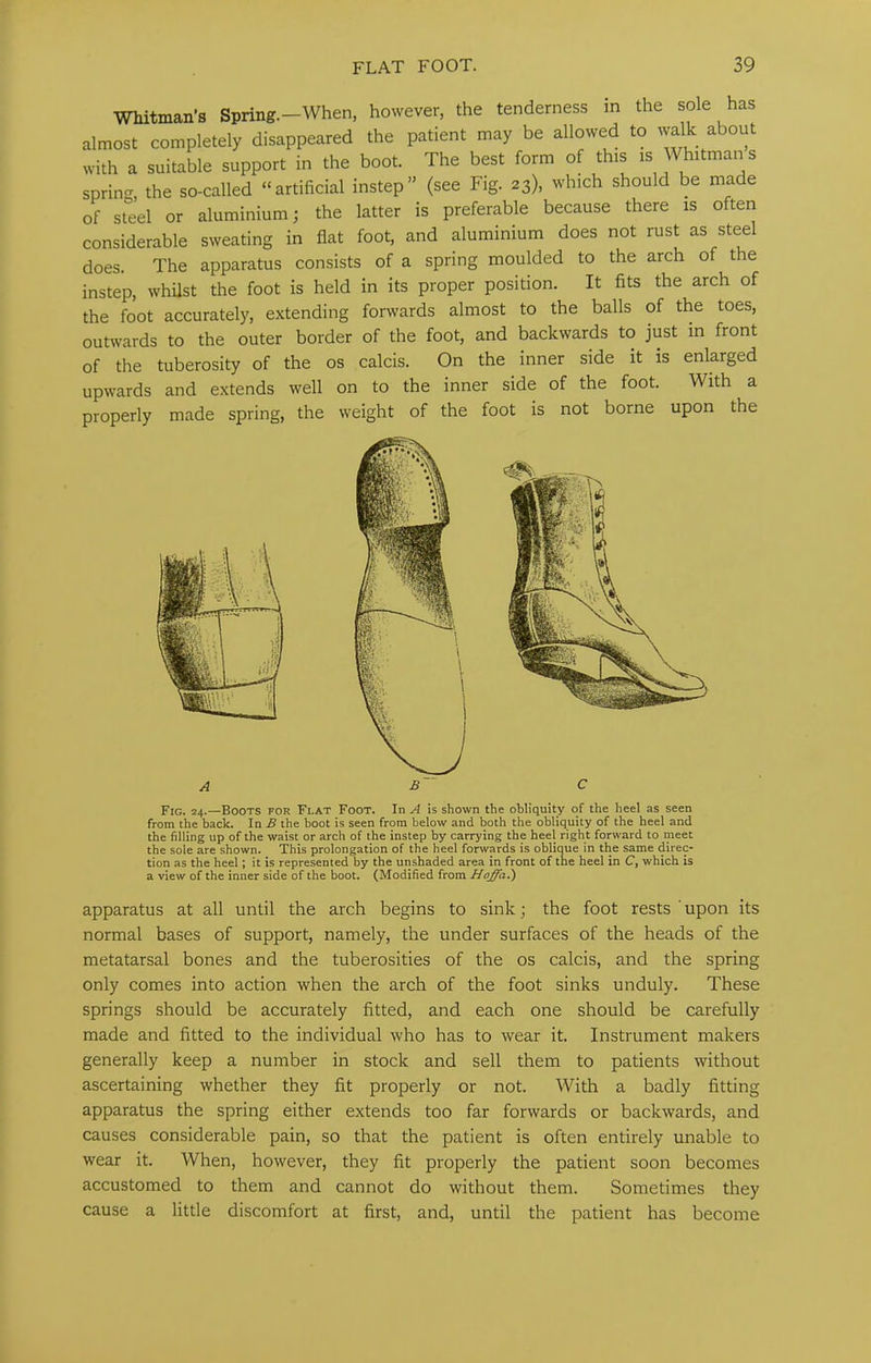Whitman’s Spring.—When, however, the tenderness in the sole has almost completely disappeared the patient may be allowed to about with a suitable support in the boot. The best form of this is Whitman s spring, the so-called “artificial instep” (see Fig. 23), which should be made of steel or aluminium; the latter is preferable because there is often considerable sweating in flat foot, and aluminium does not rust as steel does. The apparatus consists of a spring moulded to the arch of the instep, whUst the foot is held in its proper position. It fits the arch of the foot accurately, extending forwards almost to the balls of the toes, outwards to the outer border of the foot, and backwards to just in front of the tuberosity of the os calcis. On the inner side it is enlarged upwards and extends well on to the inner side of the foot. With a properly made spring, the weight of the foot is not borne upon the A c Fig. 24.—Boots for Flat Foot. In A is shown the obliquity of the heel as seen from the back. In B the boot is seen from below and both the obliquity of the heel and the filling up of the waist or arch of the instep by carrying the heel right forward to meet the sole are shown. This prolongation of the heel forwards is oblique in the same direc- tion as the heel; it is represented by the unshaded area in front of the heel in C, which is a view of the inner side of the boot. (Modified from Hqffa.~) apparatus at all until the arch begins to sink; the foot rests ' upon its normal bases of support, namely, the under surfaces of the heads of the metatarsal bones and the tuberosities of the os calcis, and the spring only comes into action when the arch of the foot sinks unduly. These springs should be accurately fitted, and each one should be carefully made and fitted to the individual who has to wear it. Instrument makers generally keep a number in stock and sell them to patients without ascertaining whether they fit properly or not. With a badly fitting apparatus the spring either extends too far forwards or backwards, and causes considerable pain, so that the patient is often entirely unable to wear it. When, however, they fit properly the patient soon becomes accustomed to them and cannot do without them. Sometimes they cause a little discomfort at first, and, until the patient has become