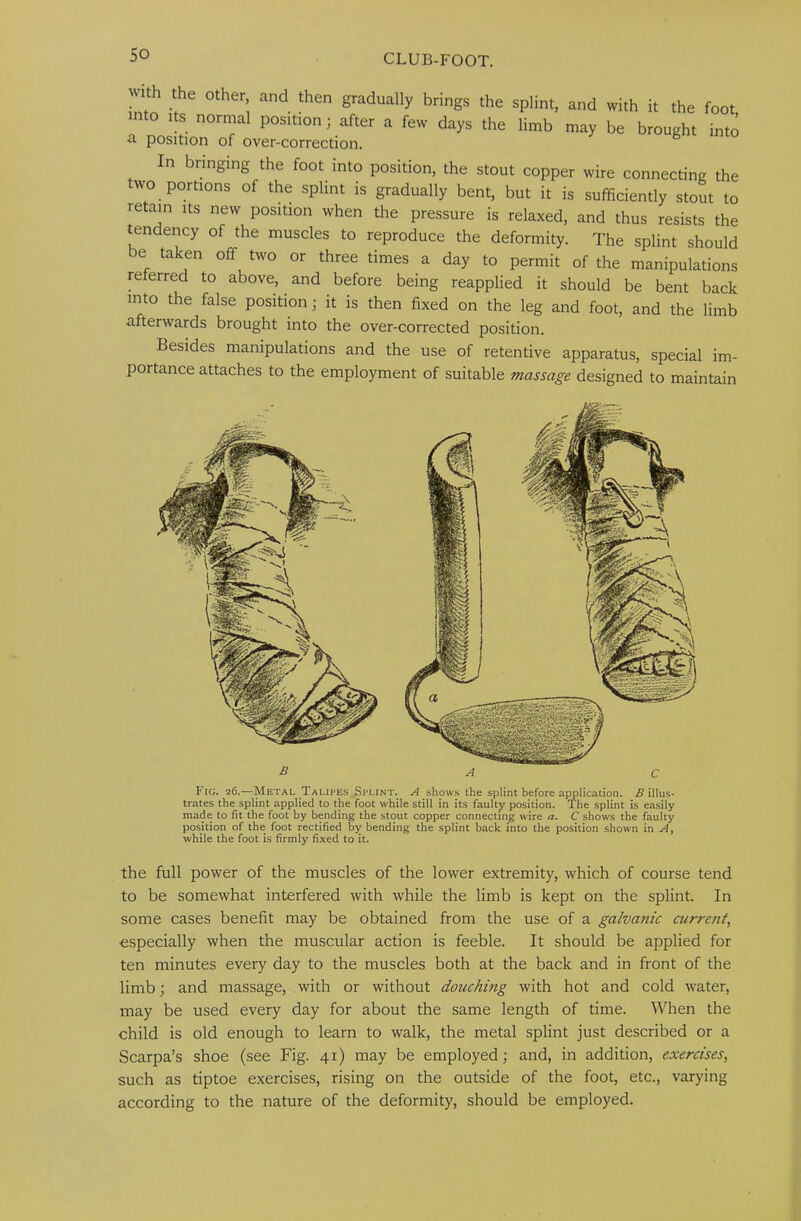 rth the other and then gradually brings the splint, and with it the foot nto Its normal position; after a few days the limb may be brought into <1. position of over-correction. In bringing the foot into position, the stout copper wire connecting the two portions of the splint is gradually bent, but it is sufficiently stout to retain its new position when the pressure is relaxed, and thus resists the tendency of the muscles to reproduce the deformity. The splint should be taken off two or three times a day to permit of the manipulations referred to above, and before being reapplied it should be bent back into the false position; it is then fixed on the leg and foot, and the limb afterwards brought into the over-corrected position. Besides manipulations and the use of retentive apparatus, special im- portance attaches to the employment of suitable massage designed to maintain B A C Fig. 26,—Metal Talipes Splint. A shows the splint before application. B illus- trates the splint applied to the foot while still in its faulty position. The splint is easily made to fit the foot by bending the stout copper connecting wire a. C shows the faulty position of the foot rectified by bending the splint back into the position shown in A, while the foot is firmly fixed to it. the full power of the muscles of the lower extremity, which of course tend to be somewhat interfered with while the limb is kept on the splint. In some cases benefit may be obtained from the use of a galvanic currait, especially when the muscular action is feeble. It should be applied for ten minutes every day to the muscles both at the back and in front of the limb; and massage, with or without douching with hot and cold water, may be used every day for about the same length of time. When the child is old enough to learn to walk, the metal splint just described or a Scarpa’s shoe (see Fig. 41) may be employed; and, in addition, exercises, such as tiptoe exercises, rising on the outside of the foot, etc., varying according to the nature of the deformity, should be employed.
