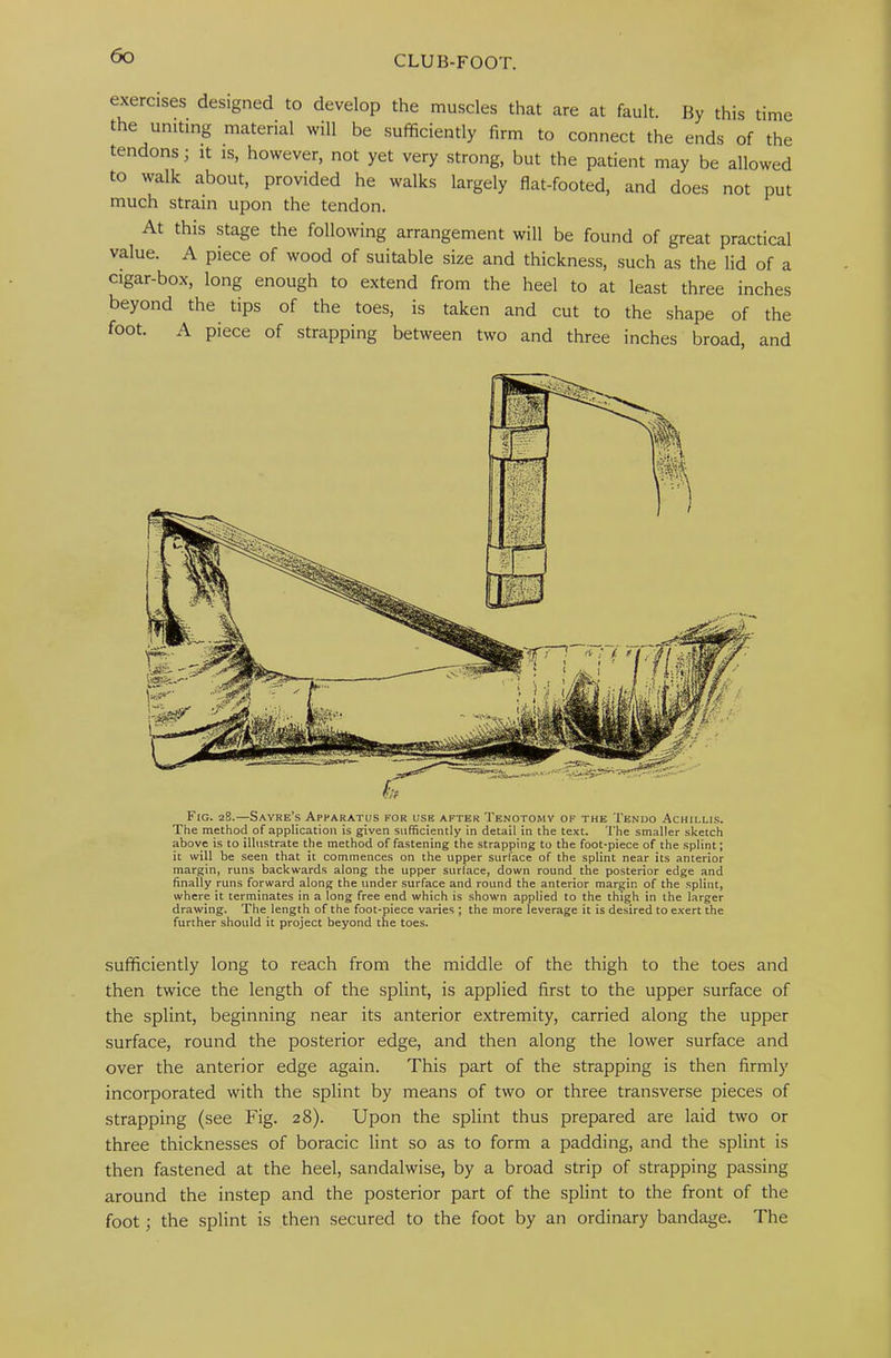exercises designed to develop the muscles that are at fault. By this time the uniting material will be sufficiently firm to connect the ends of the tendons; it is, however, not yet very strong, but the patient may be allowed to walk about, provided he walks largely flat-footed, and does not put much strain upon the tendon. At this stage the following arrangement will be found of great practical value. A piece of wood of suitable size and thickness, such as the lid of a cigar-box, long enough to extend from the heel to at least three inches beyond the tips of the toes, is taken and cut to the shape of the foot. A piece of strapping between two and three inches broad, and Fig. 28.—Sayre’s Apparatus for use after Tenotomy of the Tendo .^chillis. The method of application is given sufficiently in detail in the text. The smaller sketch above is to illustrate the method of fastening the strapping to the foot-piece of the splint; it will be seen that it commences on the upper surface of the splint near its anterior margin, runs backwards along the upper surface, down round the posterior edge and finally runs forward along the under surface and round the anterior margin of the splint, where it terminates in a long free end which is shown applied to the thigh in the larger drawing. The length of the foot-piece varies ; the more leverage it is desired to exert the further should it project beyond the toes. sufficiently long to reach from the middle of the thigh to the toes and then twice the length of the splint, is applied first to the upper surface of the splint, beginning near its anterior extremity, carried along the upper surface, round the posterior edge, and then along the lower surface and over the anterior edge again. This part of the strapping is then firmly incorporated with the splint by means of two or three transverse pieces of strapping (see Fig. 28). Upon the splint thus prepared are laid two or three thicknesses of boracic lint so as to form a padding, and the splint is then fastened at the heel, sandalwise, by a broad strip of strapping passing around the instep and the posterior part of the splint to the front of the foot; the splint is then secured to the foot by an ordinary bandage. The