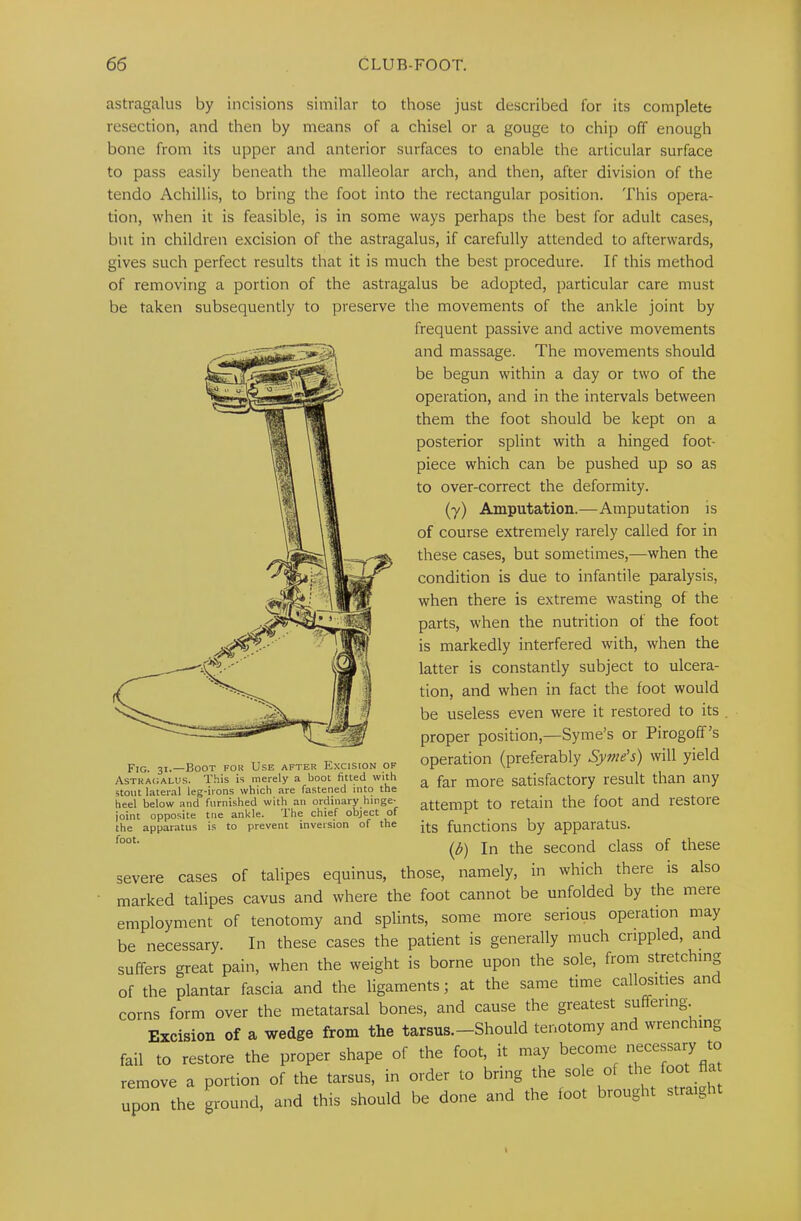 astragalus by incisions similar to those just described for its complete resection, and then by means of a chisel or a gouge to chip off enough bone from its upper and anterior surfaces to enable the articular surface to pass easily beneath the malleolar arch, and then, after division of the tendo Achillis, to bring the foot into the rectangular position. This opera- tion, when it is feasible, is in some ways perhaps the best for adult cases, but in children excision of the astragalus, if carefully attended to afterwards, gives such perfect results that it is much the best procedure. If this method of removing a portion of the astragalus be adopted, particular care must be taken subsequently to preserve the movements of the ankle joint by frequent passive and active movements and massage. The movements should be begun within a day or two of the operation, and in the intervals between them the foot should be kept on a posterior splint with a hinged foot- piece which can be pushed up so as to over-correct the deformity. (y) Amputation.—Amputation is of course extremely rarely called for in these cases, but sometimes,—when the condition is due to infantile paralysis, when there is extreme wasting of the parts, when the nutrition of the foot is markedly interfered with, when the latter is constantly subject to ulcera- tion, and when in fact the foot would be useless even were it restored to its , proper position,—Syme’s or Pirogoff’s operation (preferably Syme’s) will yield a far more satisfactory result than any attempt to retain the foot and restoie its functions by apparatus. (d) In the second class of these severe cases of talipes equinus, those, namely, in which there is also marked talipes cavus and where the foot cannot be unfolded by the mere employment of tenotomy and splints, some more serious operation may be necessary. In these cases the patient is generally much crippled, and suffers great pain, when the weight is borne upon the sole, from stretching of the plantar fascia and the ligaments; at the same time callosities and corns form over the metatarsal bones, and cause the greatest suffering. Excision of a wedge from the tarsus.—Should tenotomy and wrenching fail to restore the proper shape of the foot, it may become remove a portion of the tarsus, in order to bring the sole o le upon the ground, and this should be done and the foot brought straig Fig. 31.—Boot for Use after Excision of Astragalus. This is merely a boot fitted with stout lateral leg-irons which are fastened into the heel below and furnished with an ordinary hinge- joint opposite trie ankle. The chief object of the apparatus is to prevent inversion of the foot.