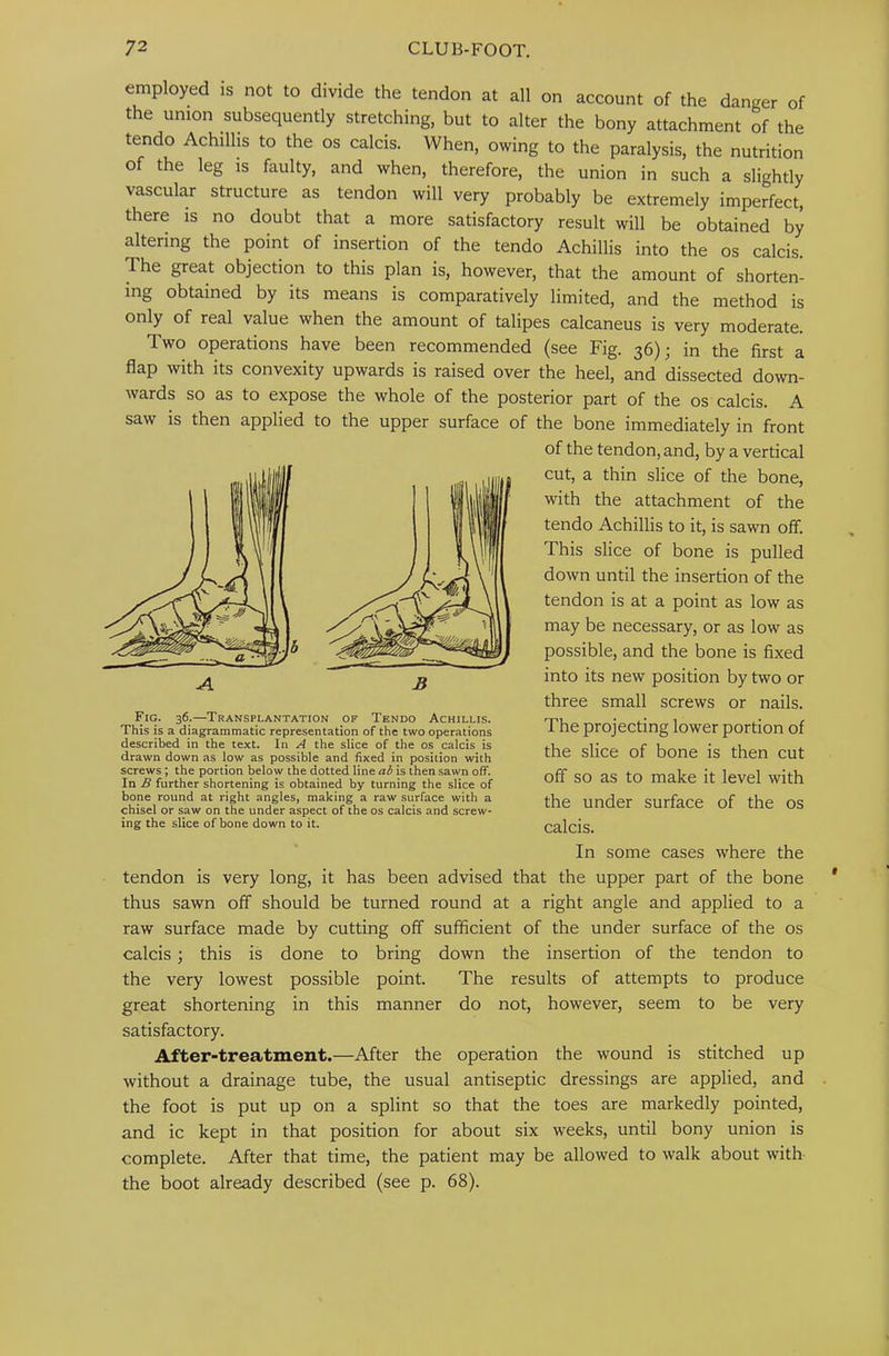 employed is not to divide the tendon at all on account of the danger of the union subsequently stretching, but to alter the bony attachment of the tendo Achilhs to the os calcis. When, owing to the paralysis, the nutrition of the leg is faulty, and when, therefore, the union in such a slightly vascular structure as tendon will very probably be extremely imperfect, there is no doubt that a more satisfactory result will be obtained by altering the point of insertion of the tendo Achillis into the os calcis. The great objection to this plan is, however, that the amount of shorten- ing obtained by its means is comparatively limited, and the method is only of real value when the amount of talipes calcaneus is very moderate. Two operations have been recommended (see Fig. 36); in the first a flap with its convexity upwards is raised over the heel, and dissected down- wards so as to expose the whole of the posterior part of the os calcis. A saw is then applied to the upper surface of the bone immediately in front of the tendon, and, by a vertical cut, a thin slice of the bone, with the attachment of the tendo Achillis to it, is sawn oif. This slice of bone is pulled down until the insertion of the tendon is at a point as low as may be necessary, or as low as possible, and the bone is fixed into its new position by two or three small screws or nails. The projecting lower portion of the slice of bone is then cut off so as to make it level with the under surface of the os calcis. In some cases where the tendon is very long, it has been advised that the upper part of the bone thus sawn off should be turned round at a right angle and applied to a raw surface made by cutting off sufficient of the under surface of the os calcis; this is done to bring down the insertion of the tendon to the very lowest possible point. The results of attempts to produce great shortening in this manner do not, however, seem to be very satisfactory. After-treatment.—After the operation the wound is stitched up without a drainage tube, the usual antiseptic dressings are applied, and the foot is put up on a splint so that the toes are markedly pointed, and ic kept in that position for about six weeks, until bony union is complete. After that time, the patient may be allowed to walk about with the boot already described (see p. 68). Fig. 36.—Transplantation of Tendo Achillis. This is a diagrammatic representation of the two operations described in the text. In A the slice of the os calcis is drawn down as low as possible and fixed in position with screws ; the portion below the dotted line ai is then sawn off. In B further shortening is obtained by turning the slice of bone round at right angles, making a raw surface with a chisel or saw on the under aspect of the os calcis and screw- ing the slice of bone down to it.