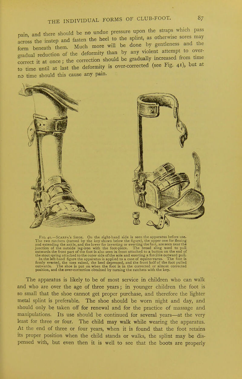 pain and there should be no undue pressure upon the straps which pass ac^s the instep and fasten the heel to the splint, as otherwise sores may form beneath them. Much more will be done by gentleness and the gradual reduction of the deformity than by any violent attem^pt to over- correct it at once; the correction should be to time until at last the deformity is over-corrected (see Fig. 41), but at no time should this cause any pain. Fig. 41.—Scarpa’s Shoe. On the right-hand side is seen the apparatus before use. The two ratchets (turned by the key shown below the figure), the upper one for flexing and extending the ankle, and the lower for inverting or everting the foot, are seen near the junction of the outside leg-iron with the foot-piece. The broad sling used to pull outwards the front part of the foot is also seen in front attached to a button on the end of the stout spring attached to the outer side of the sole and e.xerting a forcible outward pull. In the left-hand figure the apparatus is applied to a case of equino-varus. The foot is firmly everted, the toes raised, the heel depressed, and the front half of the foot pulled outwards. The shoe is put on when the foot is in the corrected or almost corrected position, and the over-correction obtained by turning the ratchets with the key. The apparatus is likely to be of most service in children who can walk and who are over the age of three years; in younger children the foot is so small that the shoe cannot get proper purchase, and therefore the lighter metal splint is preferable. The shoe should be worn night and day, and should only be taken off for renewal and for the practice of massage and manipulations. Its use should be continued for several years—at the very least for three or four. The child may walk while wearing the apparatus. At the end of three or four years, when it is found that the foot retains its proper position when the child stands or walks, the splint may be dis- pensed with, but even then it is well to see that the boots are properly