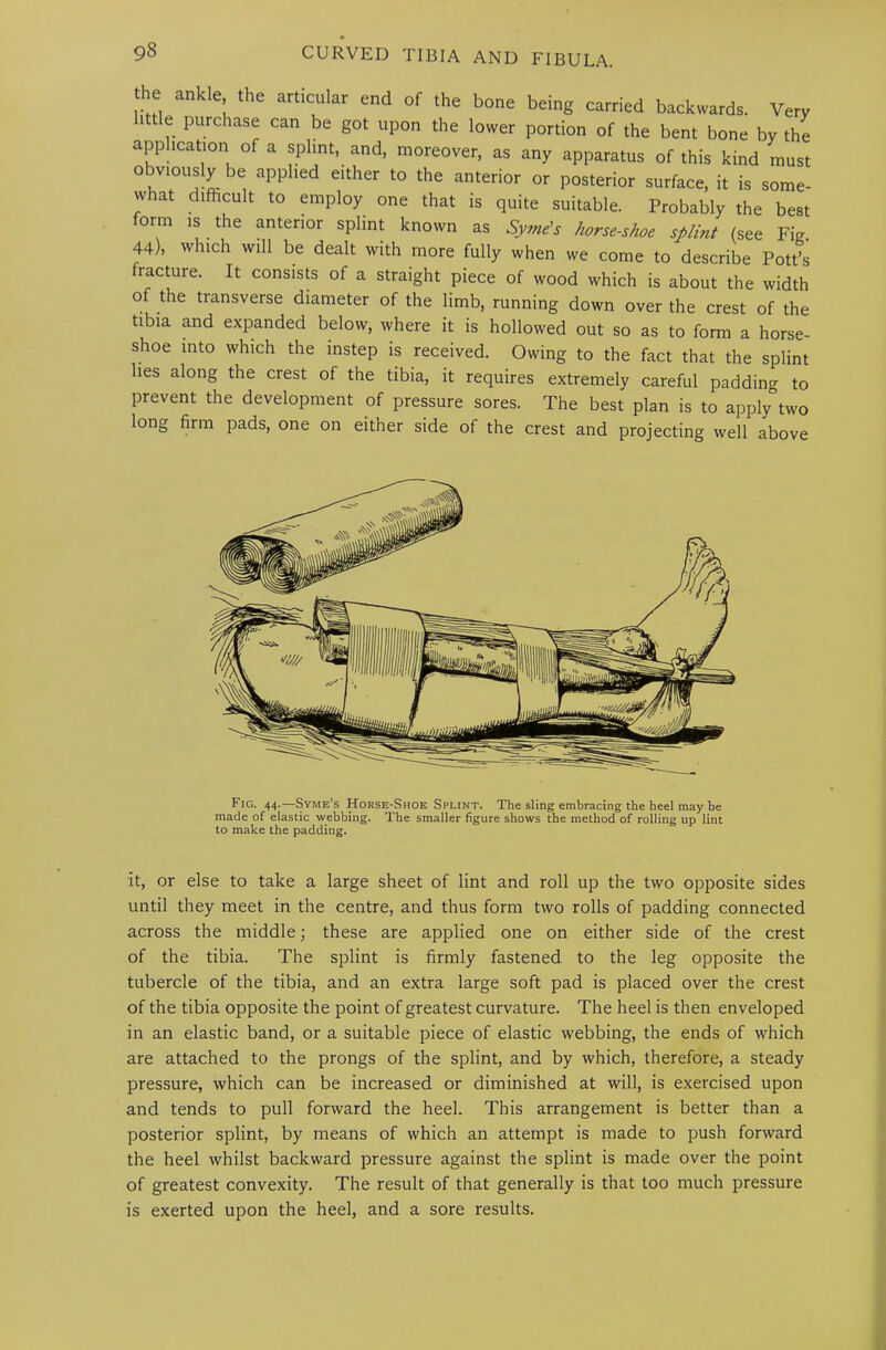 1 ankle, the articular end of the bone being carried backwards. Very little purchase can be got upon the lower portion of the bent bone by the application of a splint, and, moreover, as any apparatus of this kind must obviously be applied either to the anterior or posterior surface, it is some- wiat difficult to employ one that is quite suitable. Probably the best form IS the anterior splint known as horse-shoe splint (see Fig 44), which will be dealt with more fully when we come to describe Pott’s fracture. It consists of a straight piece of wood which is about the width of the transverse diameter of the limb, running down over the crest of the tibia and expanded below, where it is hollowed out so as to form a horse- shoe into which the instep is received. Owing to the fact that the splint lies along the crest of the tibia, it requires extremely careful padding to prevent the development of pressure sores. The best plan is to apply two long firm pads, one on either side of the crest and projecting well above Fig. 44-—Syme’s Horse-Shoe Splint. The sling embracing the heel may be made of elastic webbing. The smaller figure shows the method of rolling up lint to make the padding. it, or else to take a large sheet of lint and roll up the two opposite sides until they meet in the centre, and thus form two rolls of padding connected across the middle; these are applied one on either side of the crest of the tibia. The splint is firmly fastened to the leg opposite the tubercle of the tibia, and an extra large soft pad is placed over the crest of the tibia opposite the point of greatest curvature. The heel is then enveloped in an elastic band, or a suitable piece of elastic webbing, the ends of which are attached to the prongs of the splint, and by which, therefore, a steady pressure, which can be increased or diminished at will, is exercised upon and tends to pull forward the heel. This arrangement is better than a posterior splint, by means of which an attempt is made to push forward the heel whilst backward pressure against the splint is made over the point of greatest convexity. The result of that generally is that too much pressure is exerted upon the heel, and a sore results.